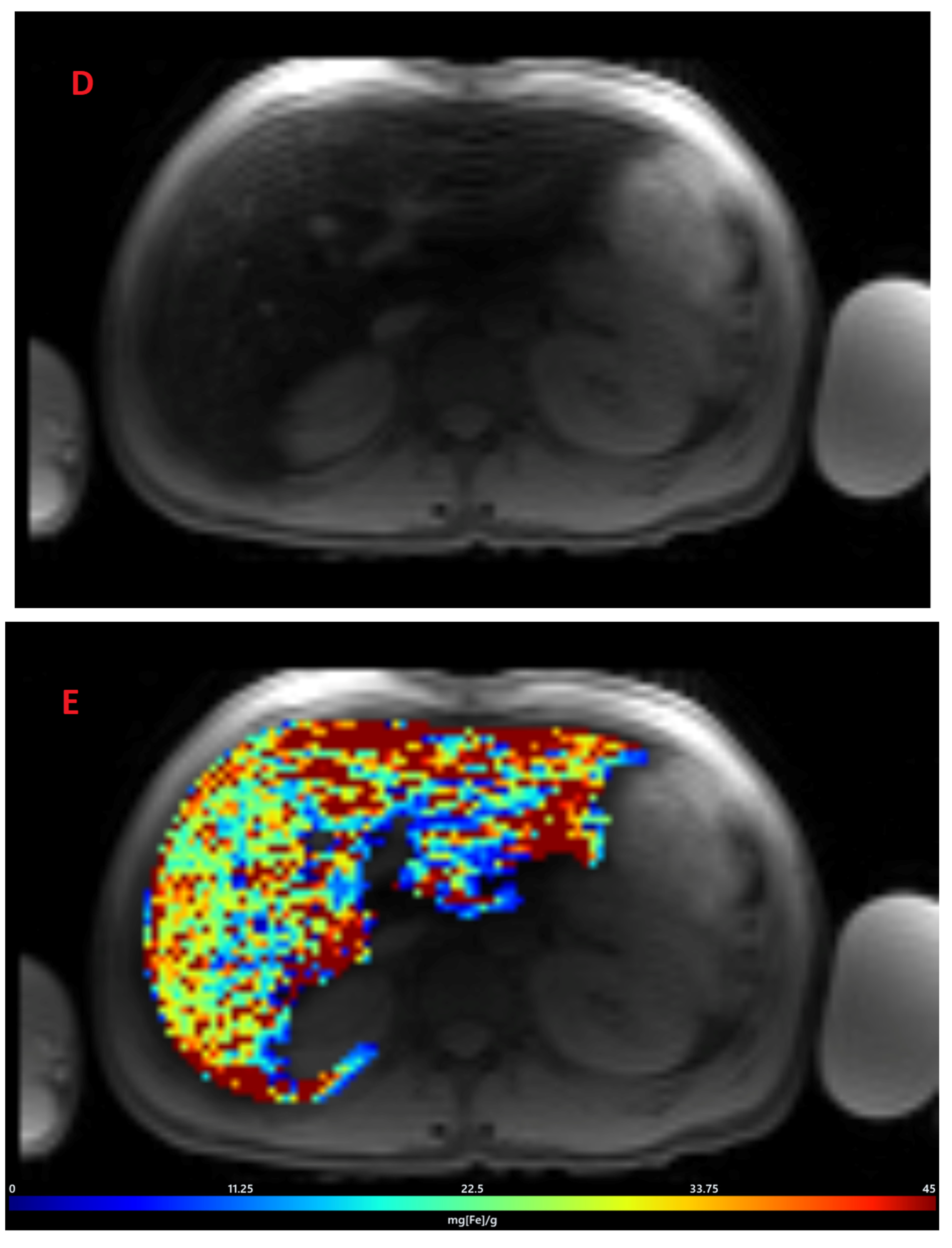 Tomography 08 00209 g002c Tomography 08 00209 g002c