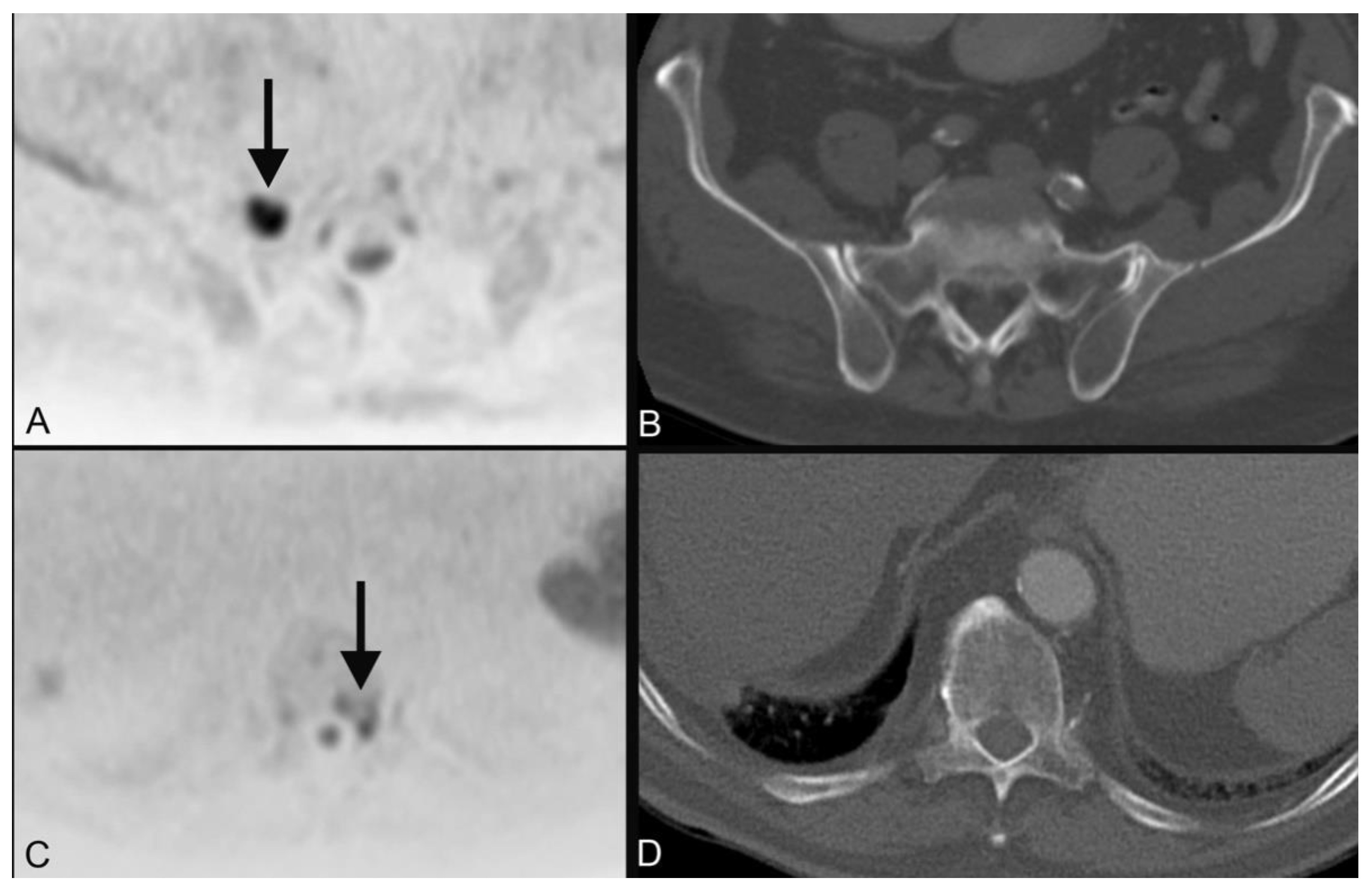 Tomography 08 00210 g003