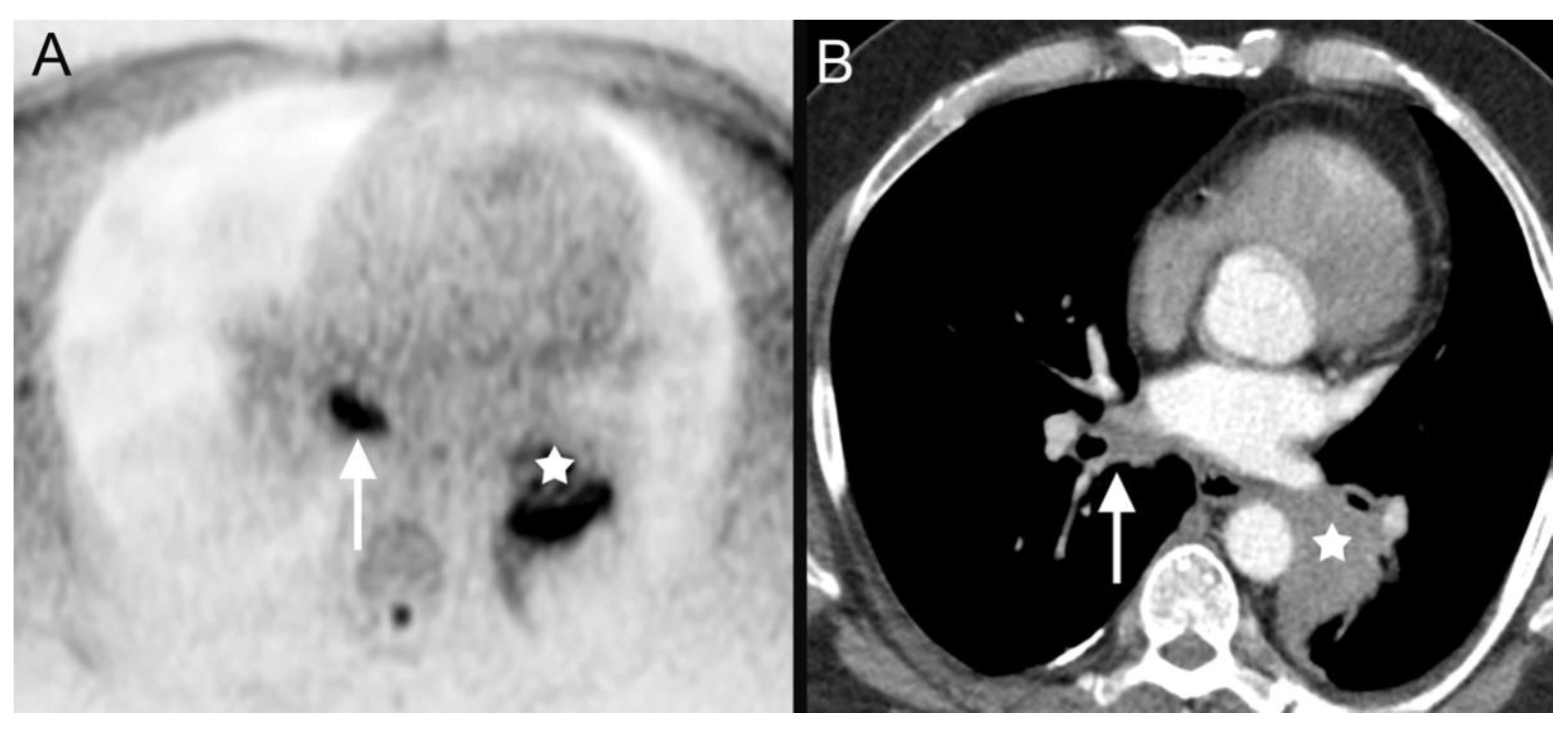 Tomography 08 00210 g004