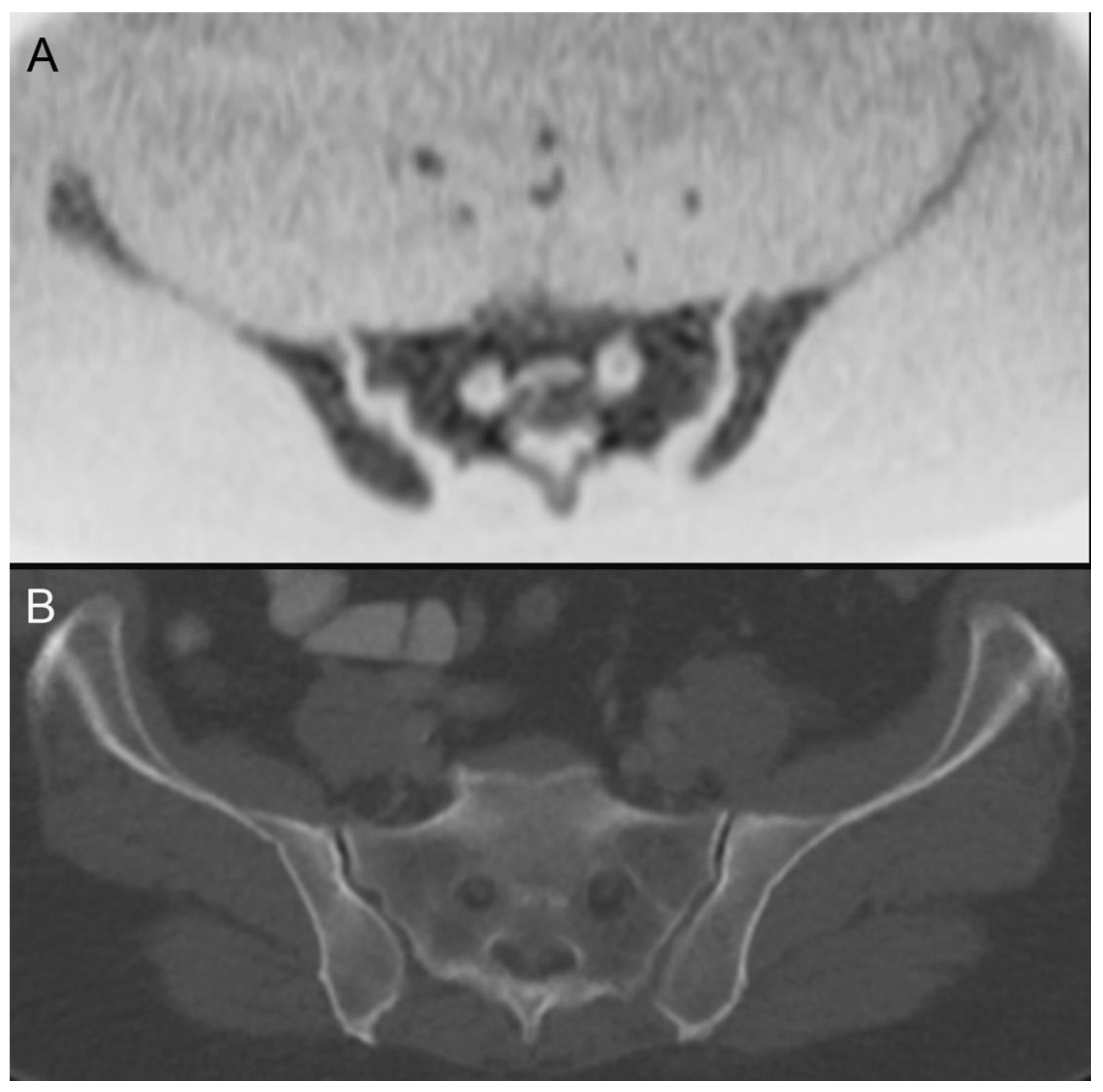 Tomography 08 00210 g005