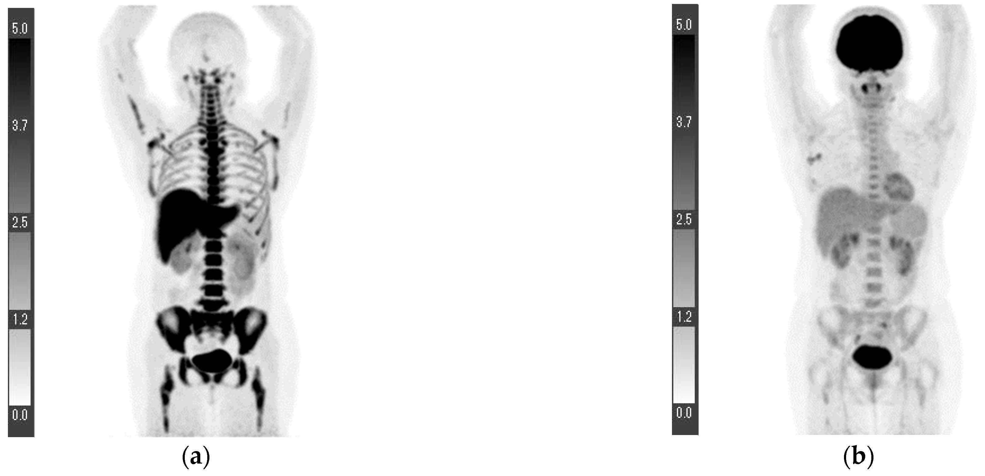 Tomography 08 00211 g001a Tomography 08 00211 g001a
