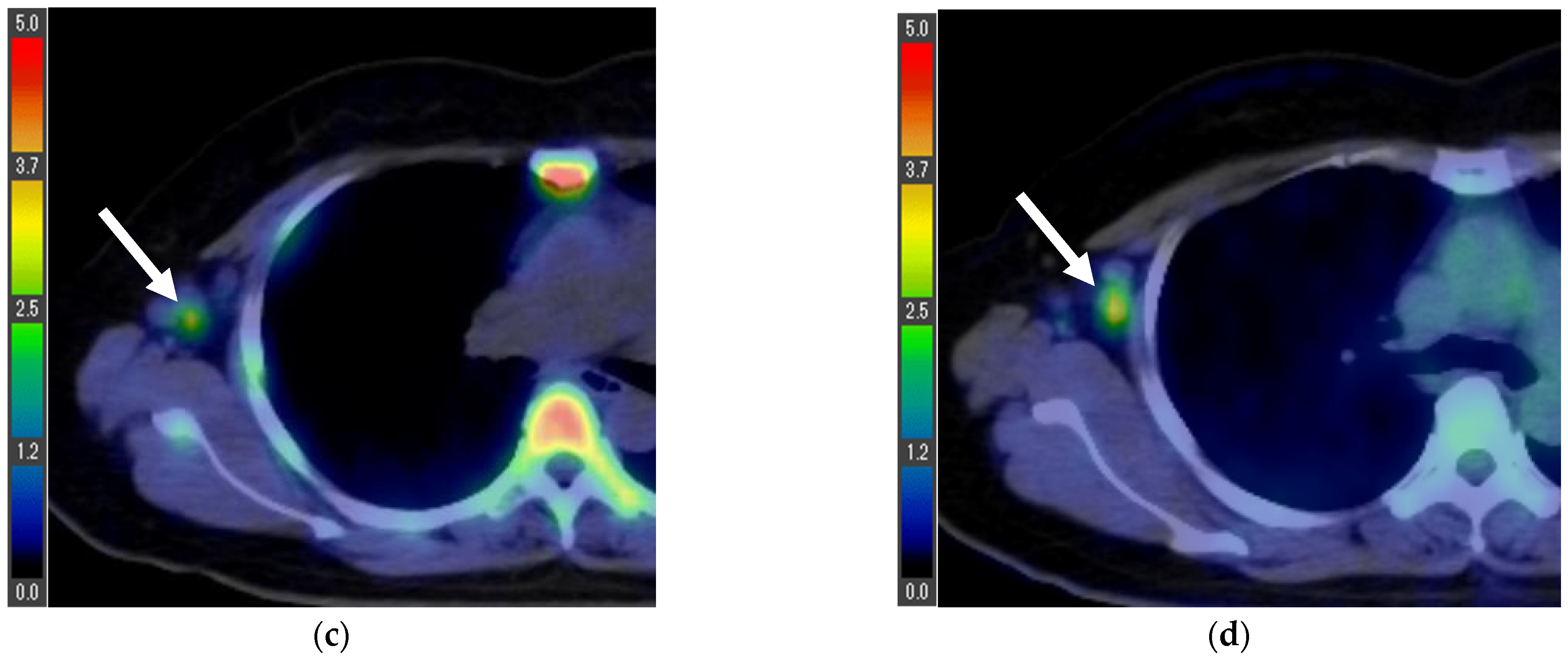 Tomography 08 00211 g001b Tomography 08 00211 g001b
