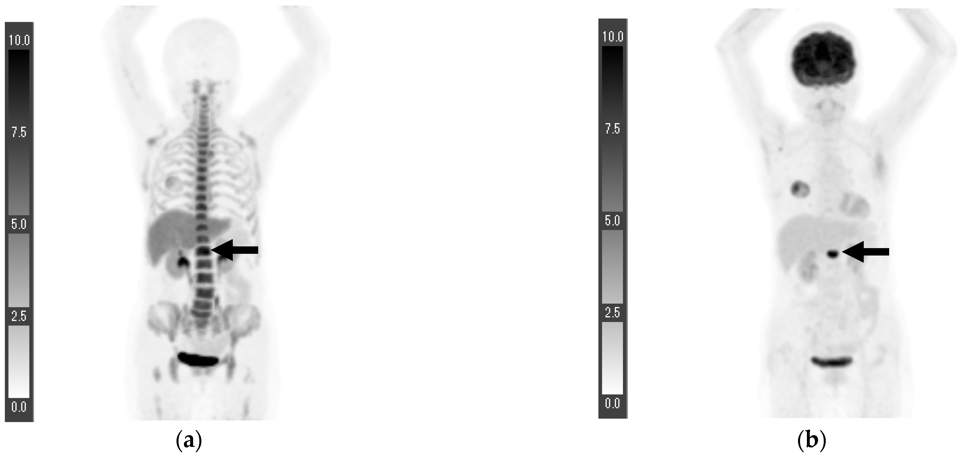 Tomography 08 00211 g003 Tomography 08 00211 g003