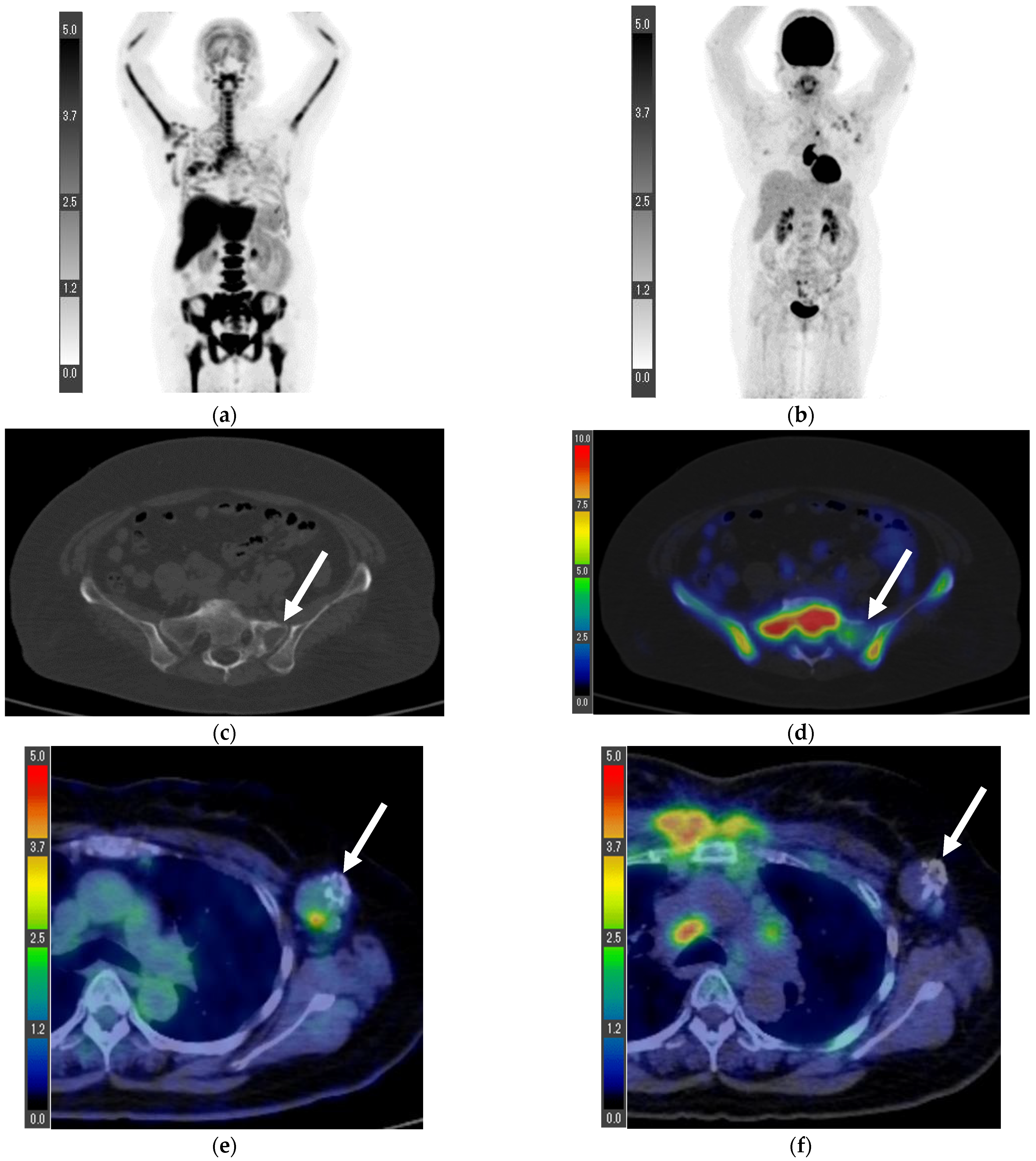 Tomography 08 00211 g006 Tomography 08 00211 g006