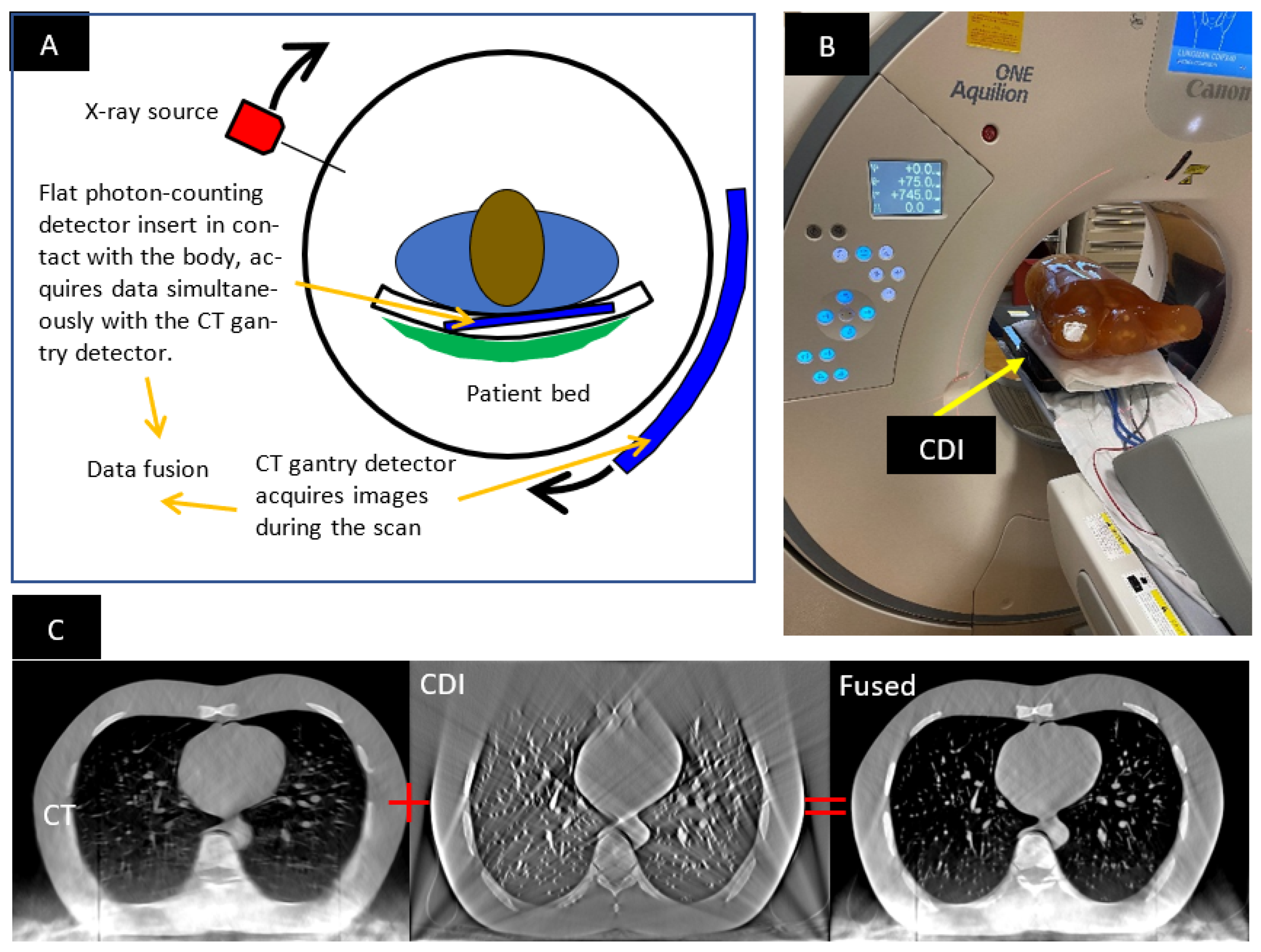 Tomography | Free Full-Text | Geometric a Hybrid CT System Ultrahigh-Resolution Imaging