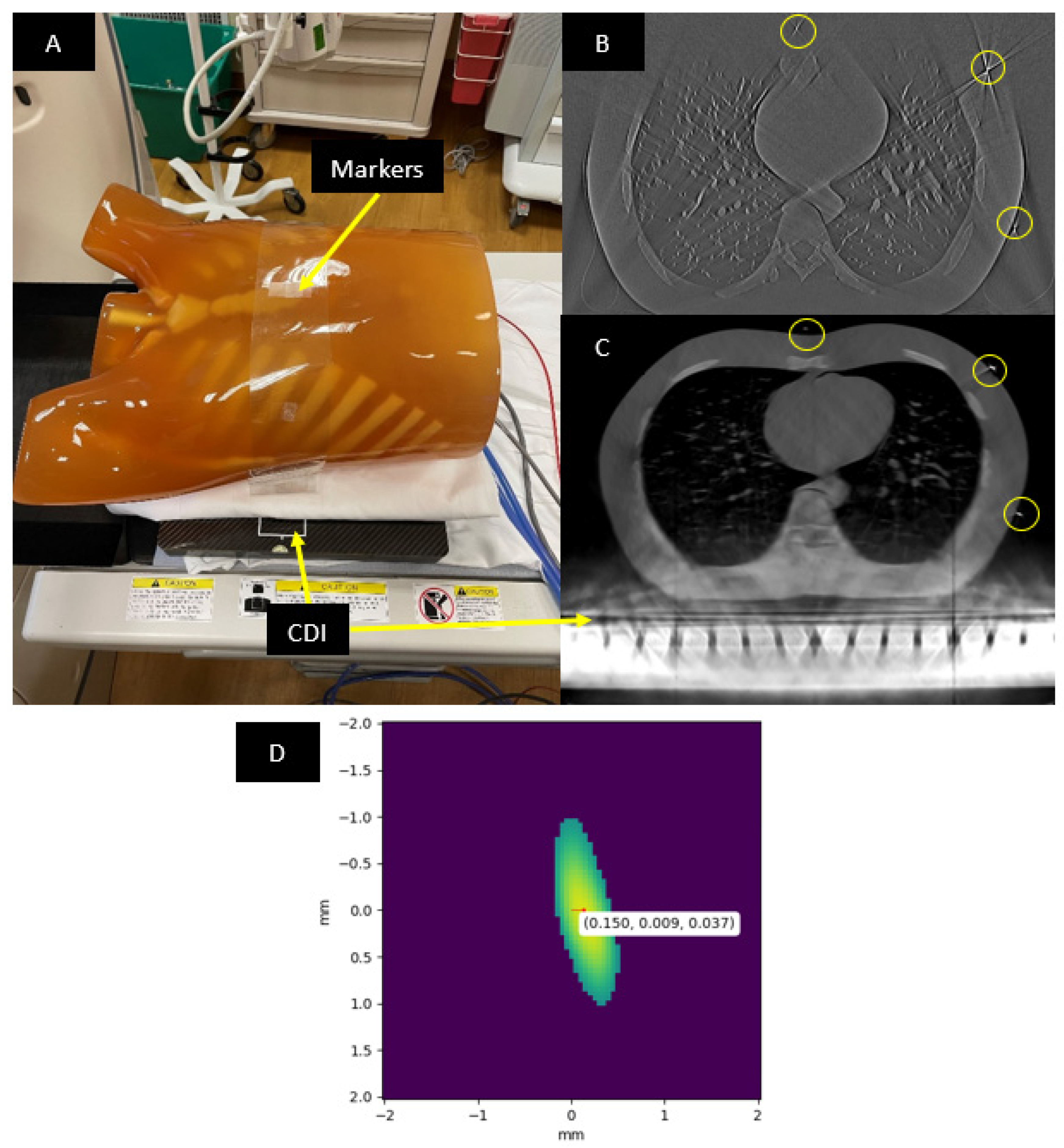 Tomography 08 00212 g002 Tomography 08 00212 g002