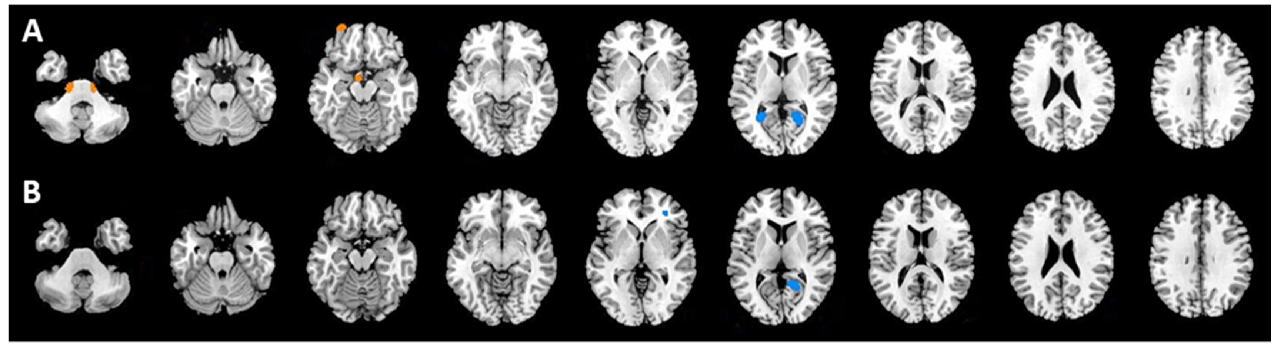 Tomography 08 00214 g002 Tomography 08 00214 g002