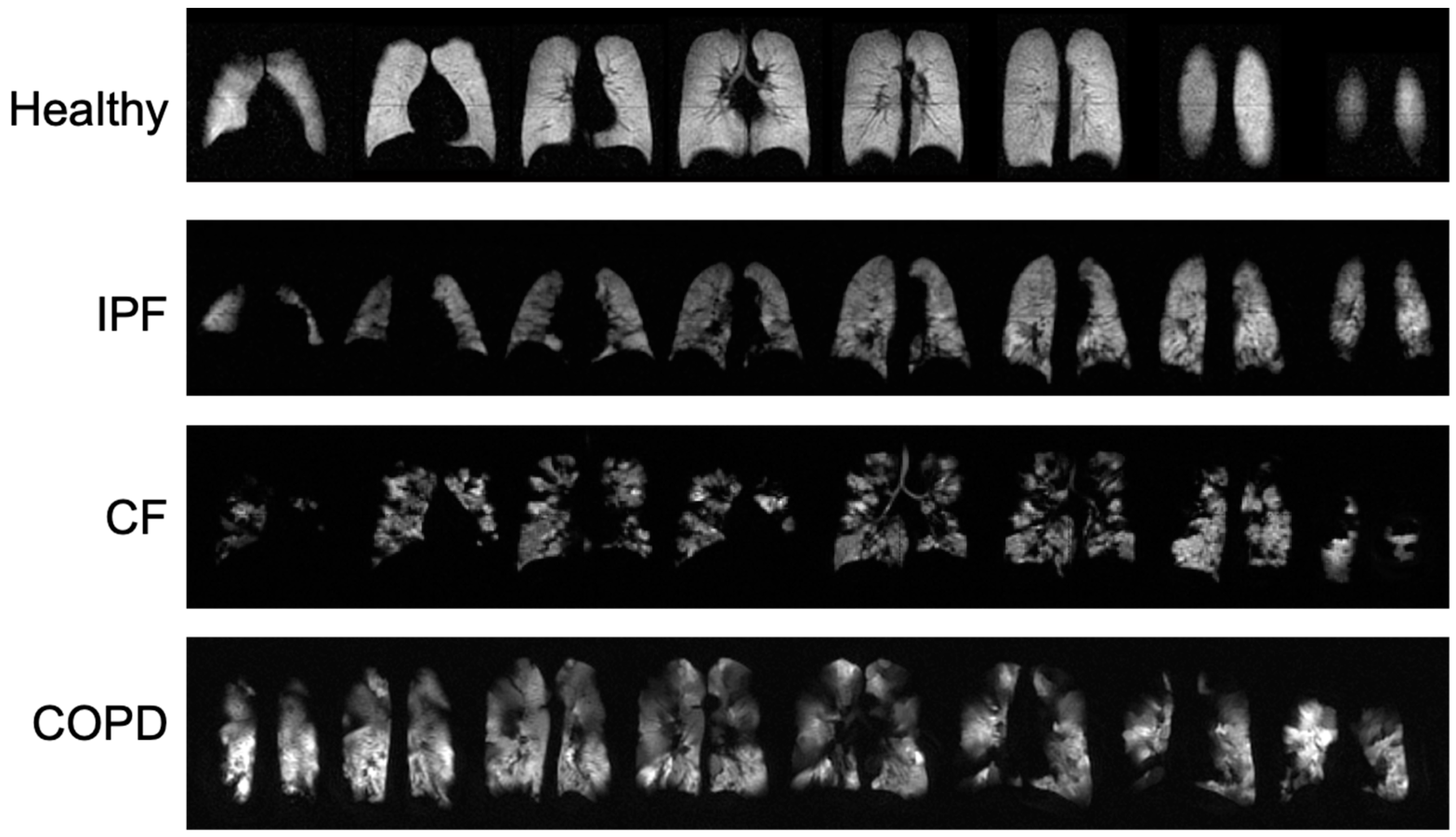 Tomography 08 00215 g001 Tomography 08 00215 g001