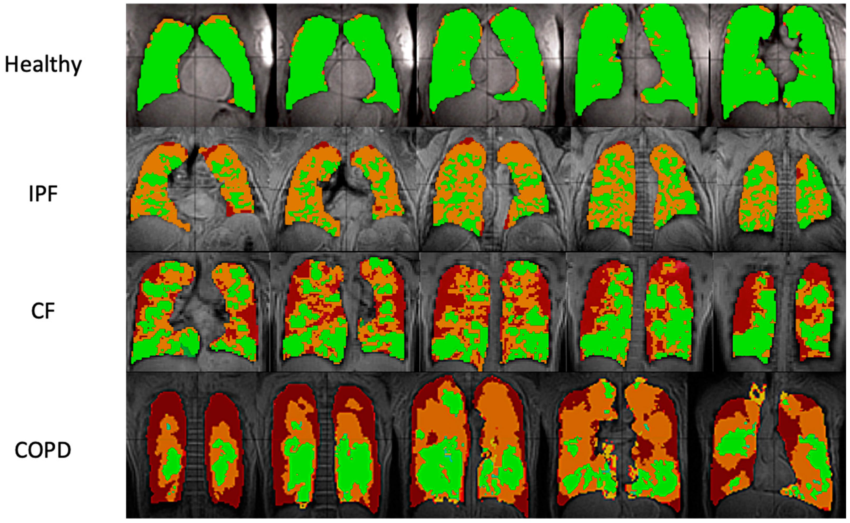 Tomography 08 00215 g002 Tomography 08 00215 g002