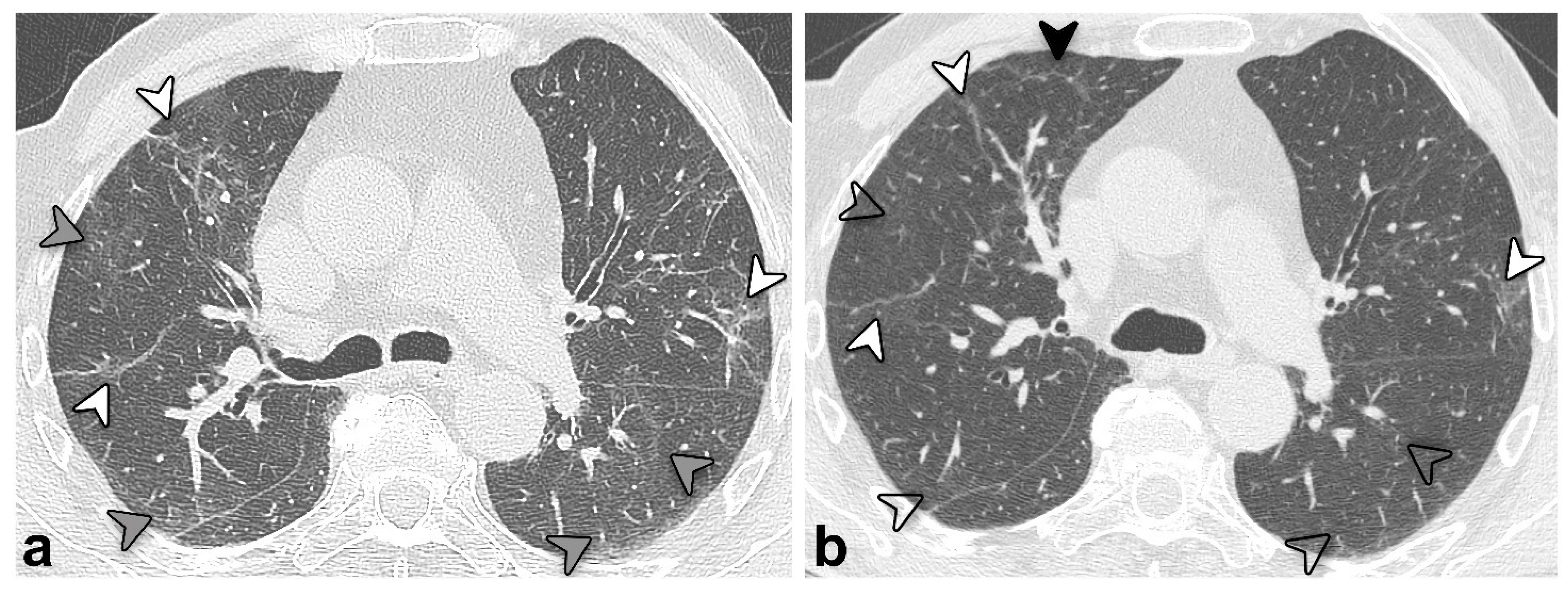 Tomography 08 00216 g003 Tomography 08 00216 g003