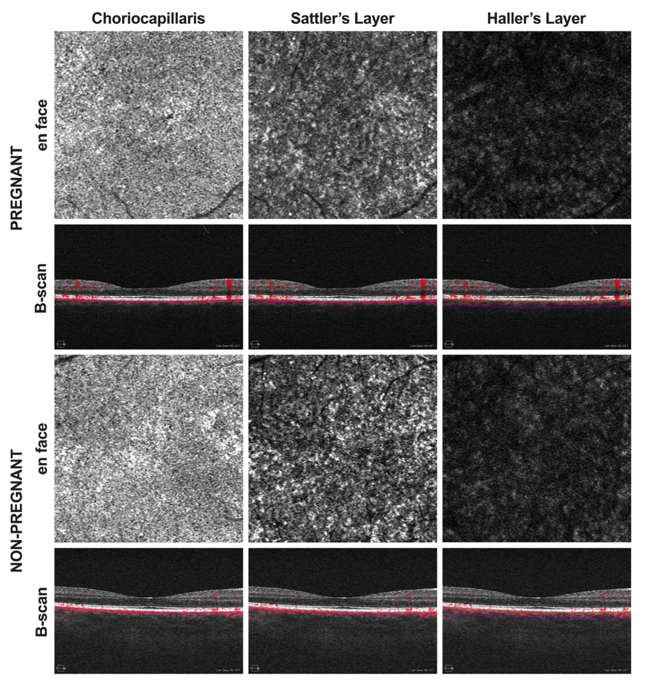 Tomography 08 00218 g001 Tomography 08 00218 g001