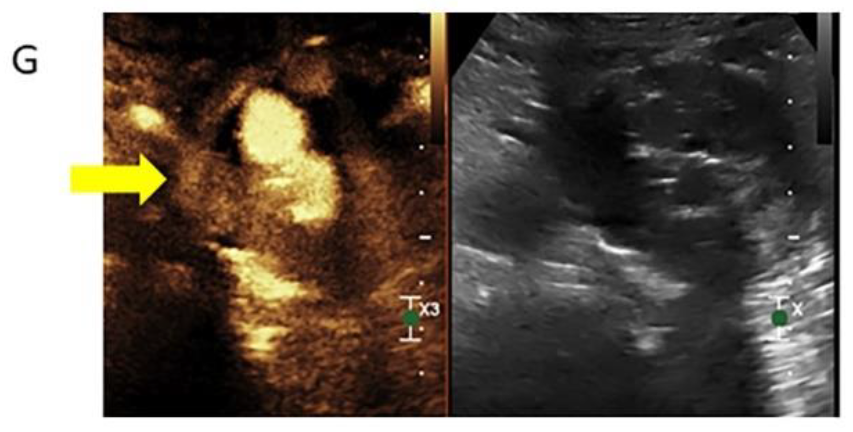 Tomography 08 00219 g003b Tomography 08 00219 g003b