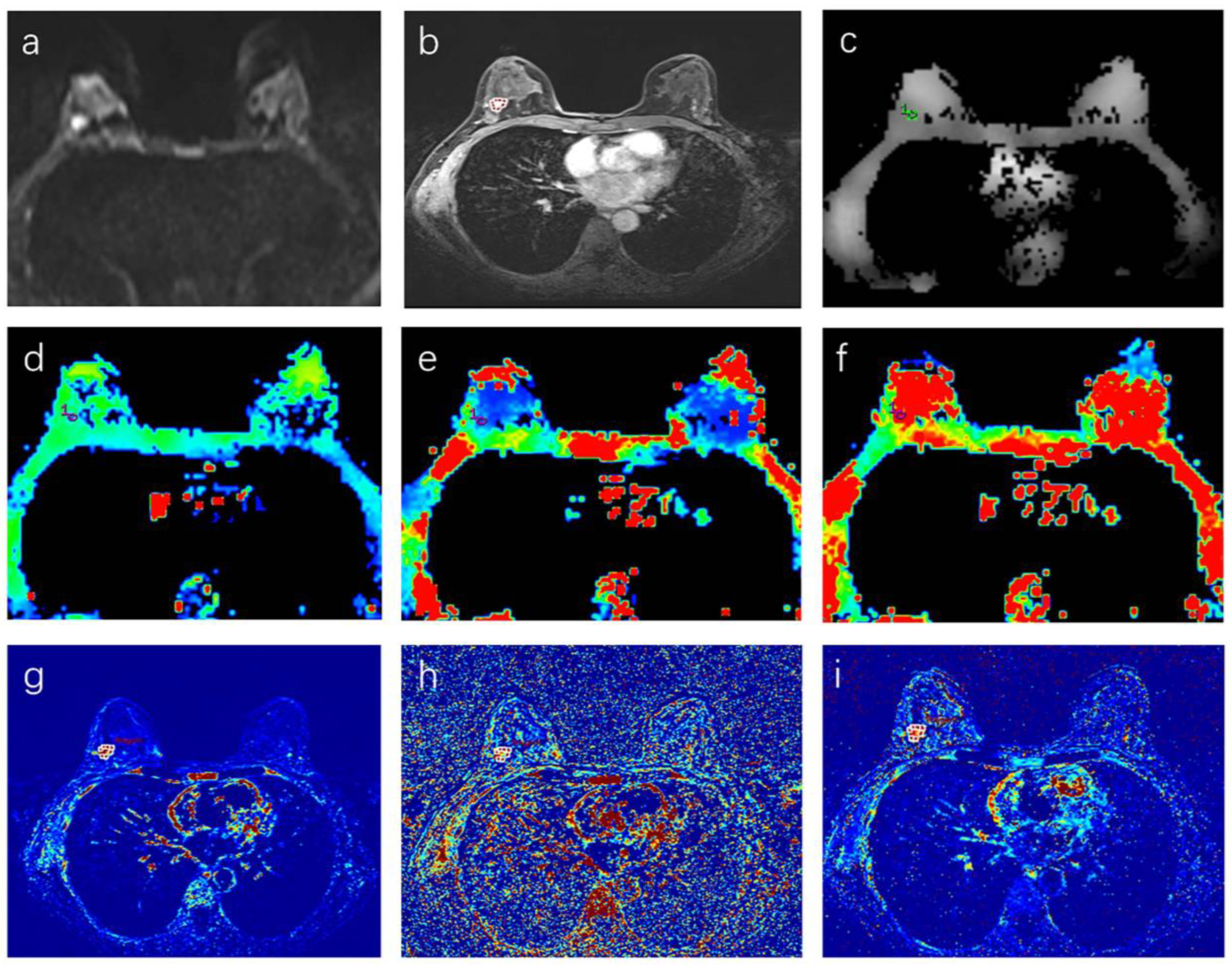 Tomography 08 00223 g001 Tomography 08 00223 g001