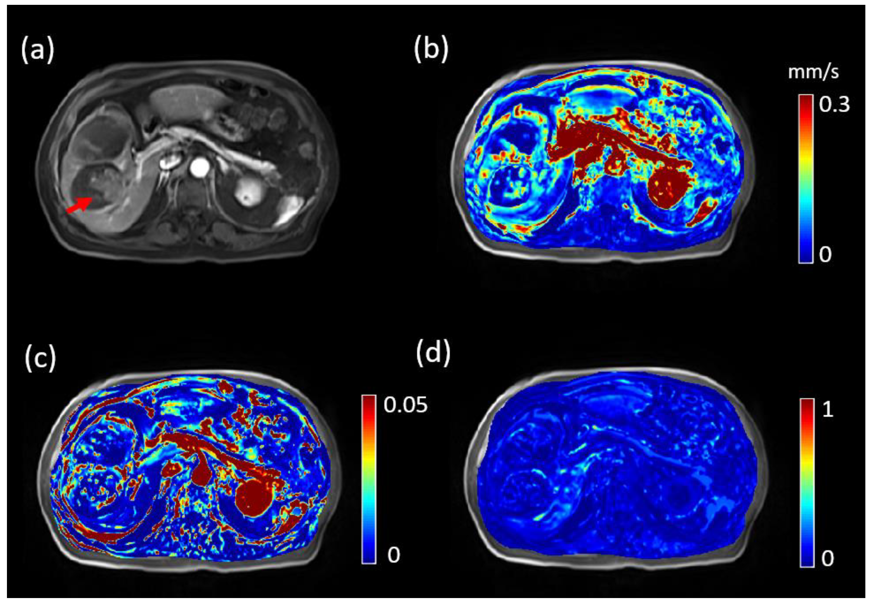 Tomography 08 00224 g002 Tomography 08 00224 g002