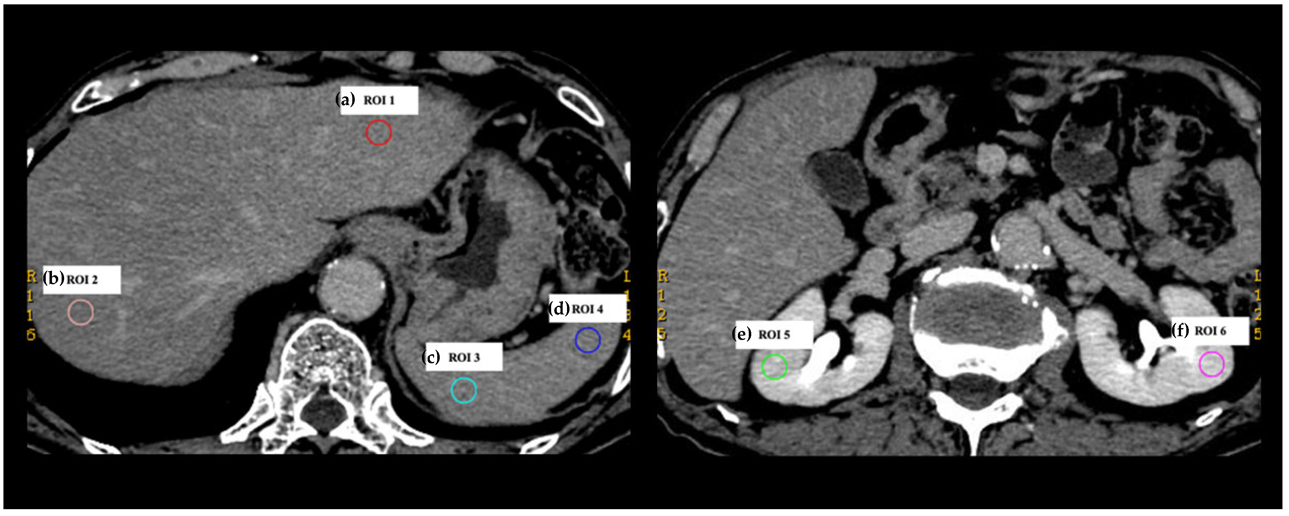 Tomography 08 00225 g002