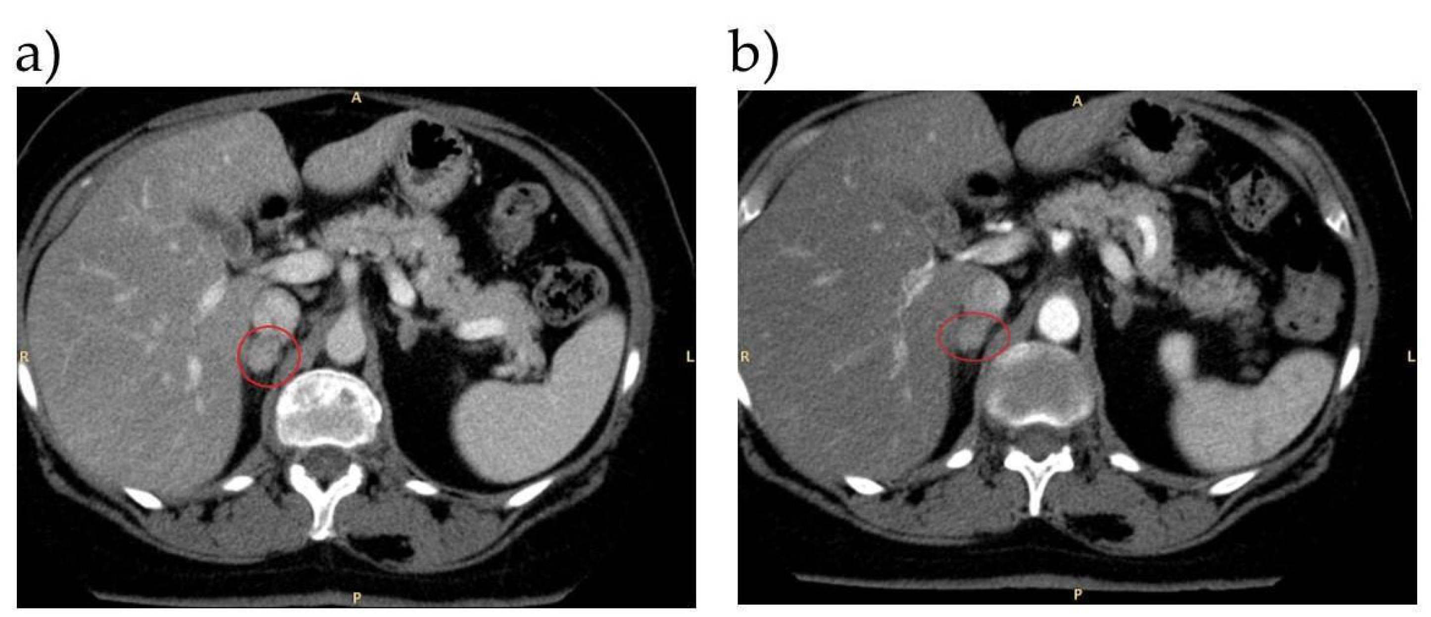 Tomography 08 00228 g002