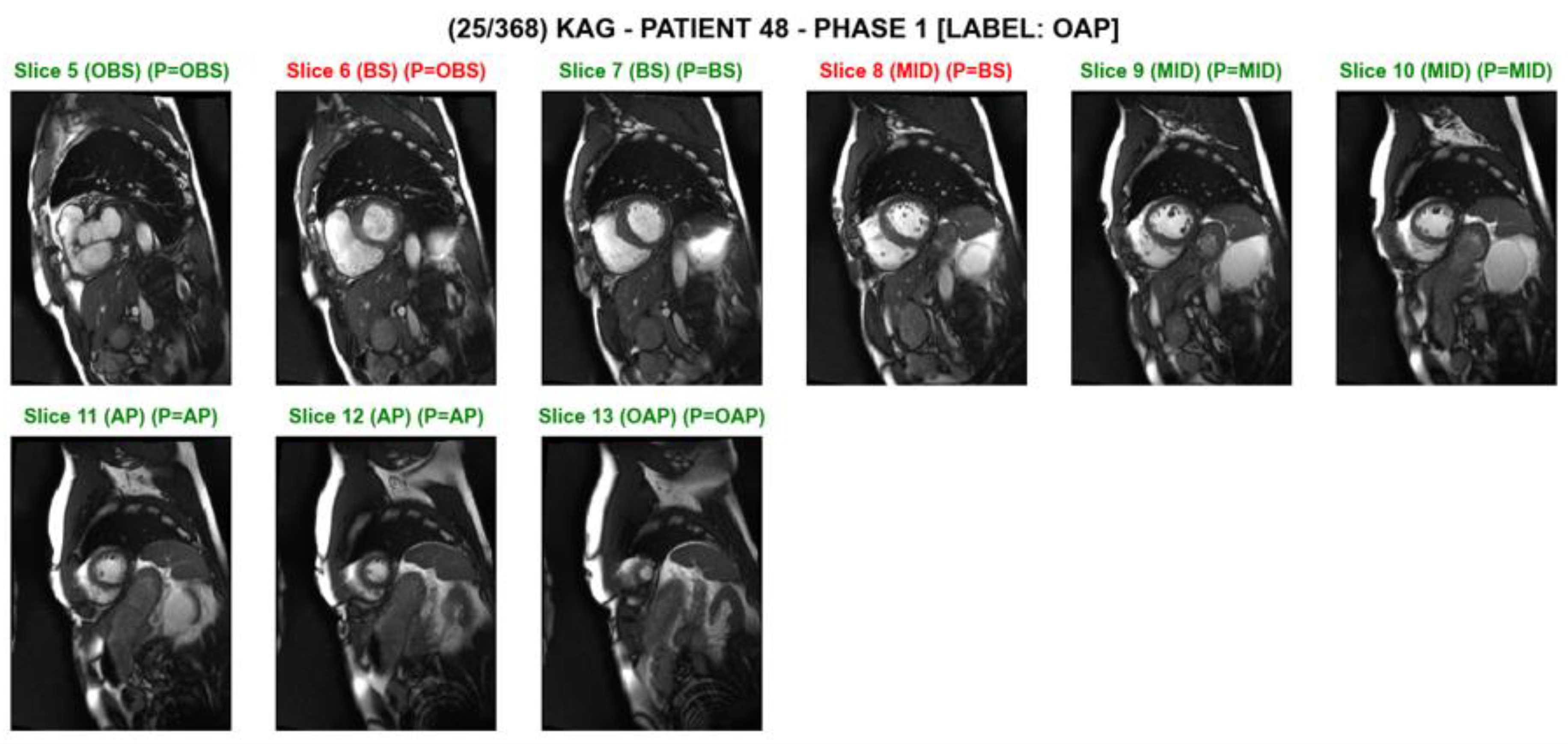 Tomography 08 00229 g003