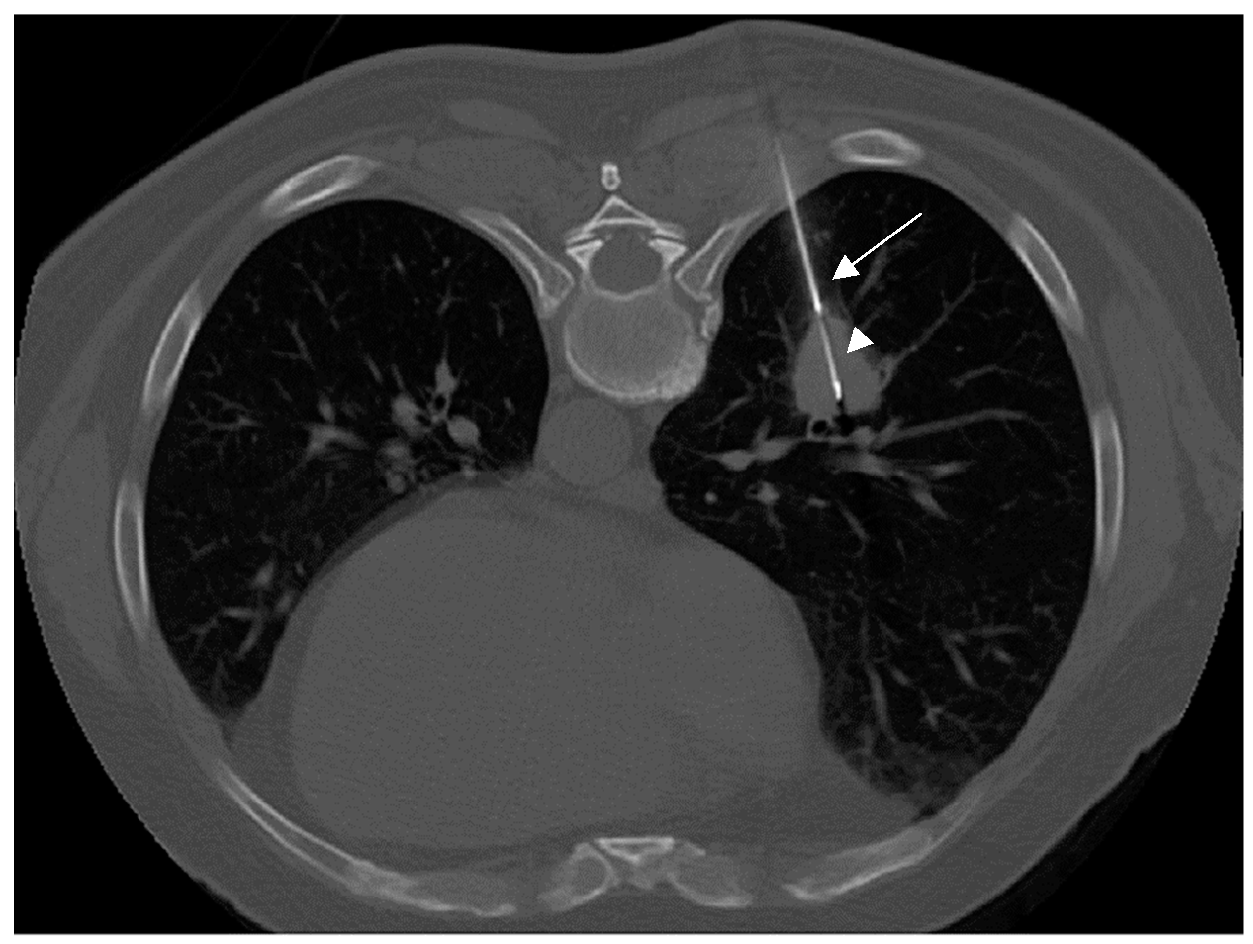 Tomography 08 00236 g001 Tomography 08 00236 g001