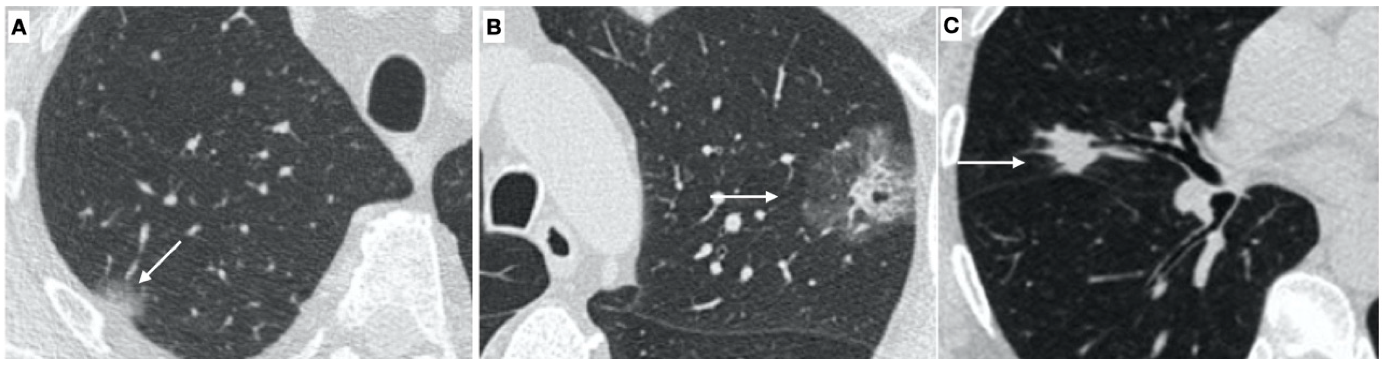 Tomography 08 00236 g002 Tomography 08 00236 g002