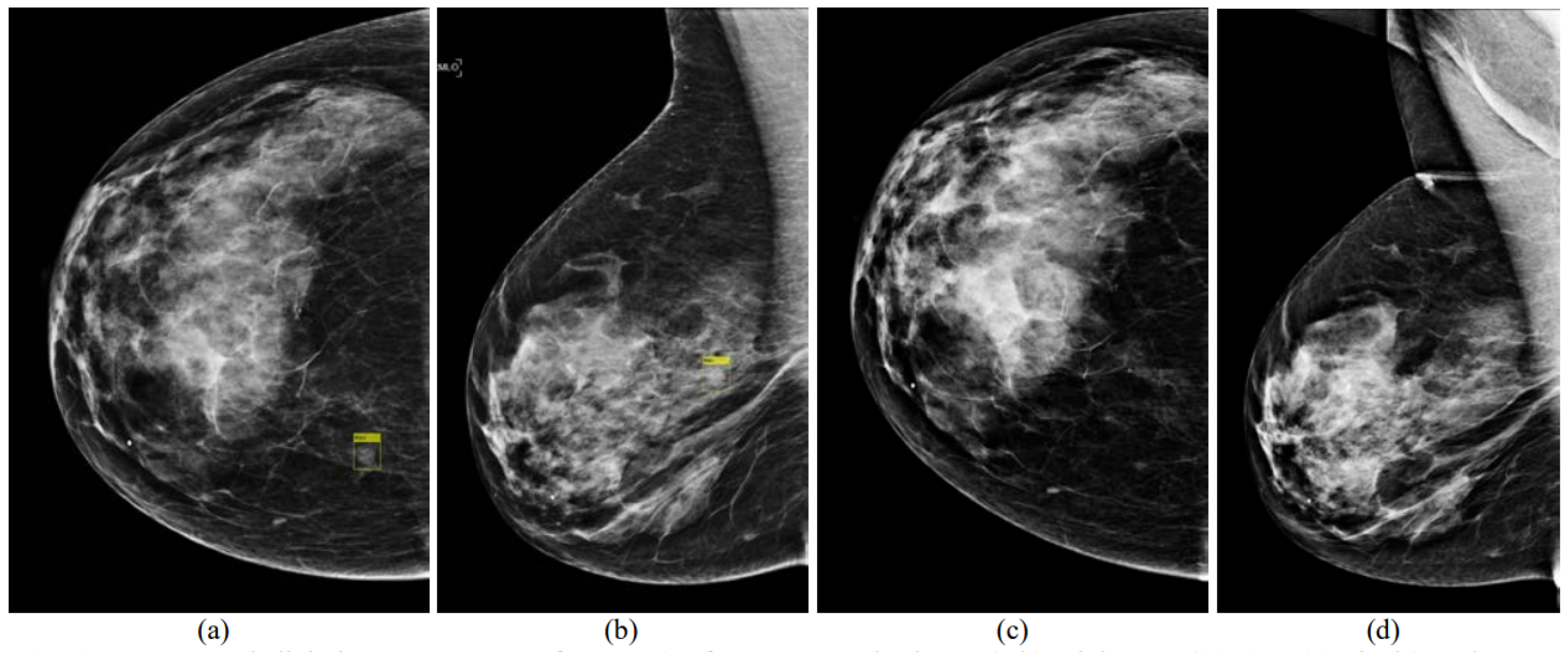 Tomography 08 00241 g004 Tomography 08 00241 g004
