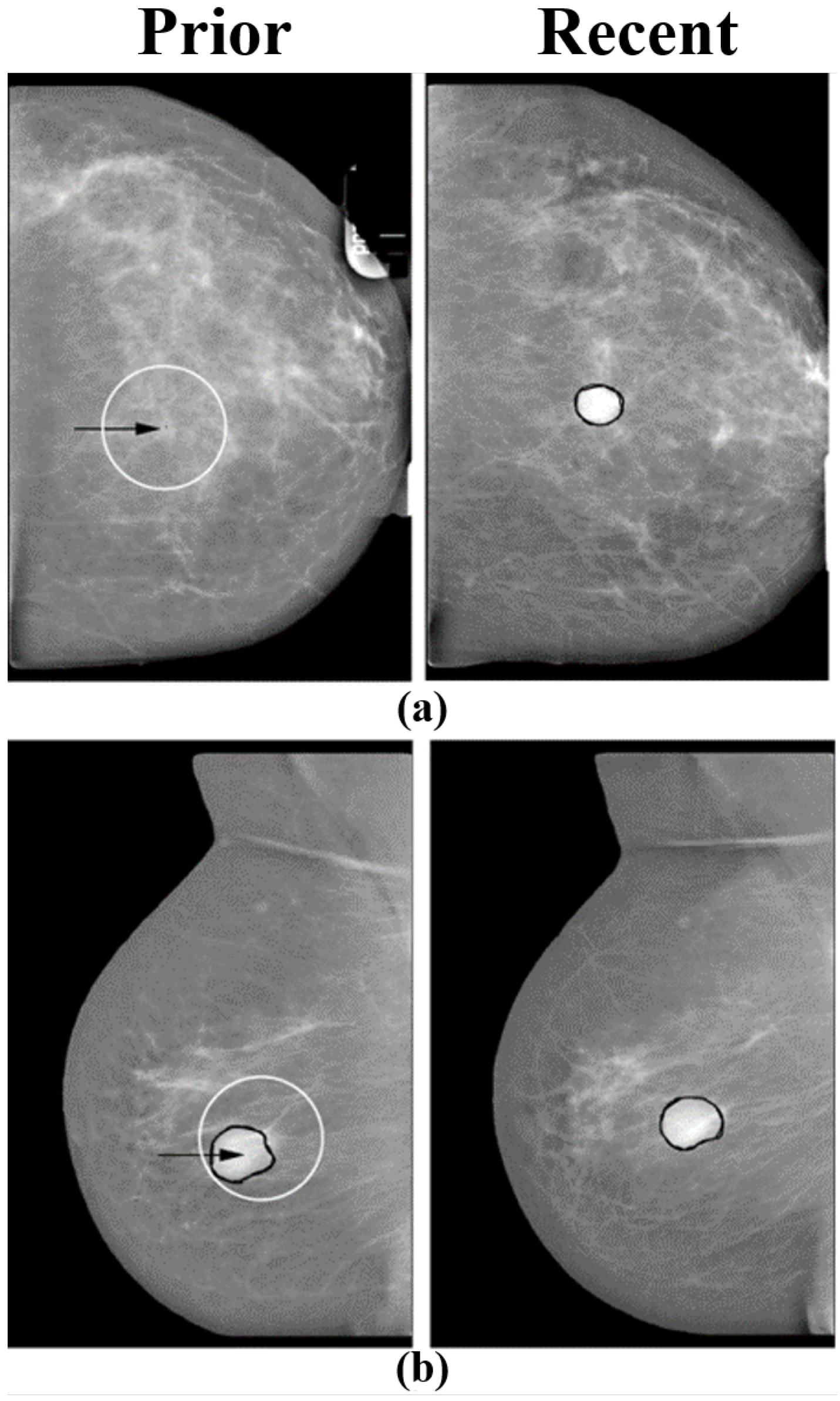 Tomography 08 00241 g005 Tomography 08 00241 g005