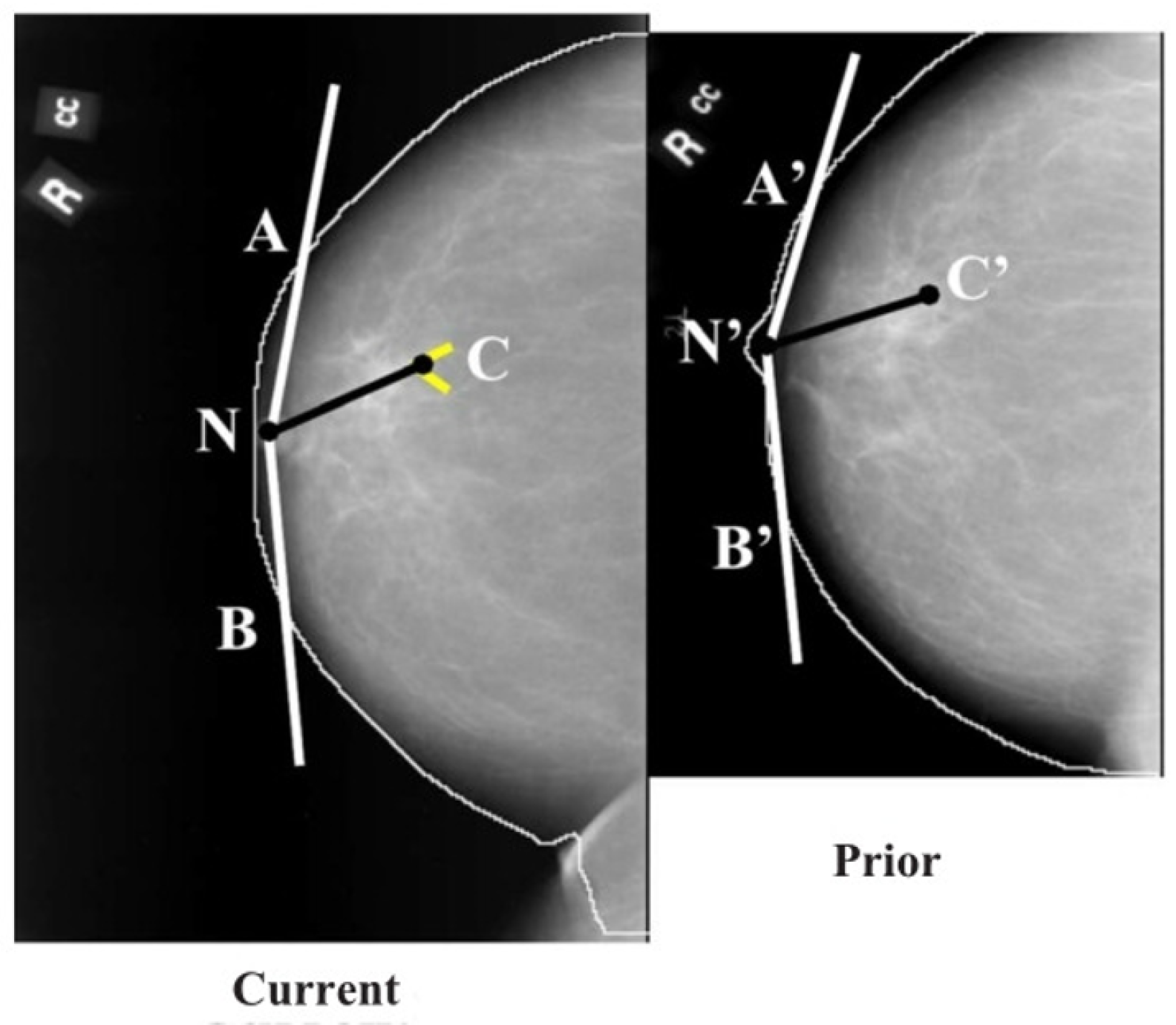 Tomography 08 00241 g007 Tomography 08 00241 g007