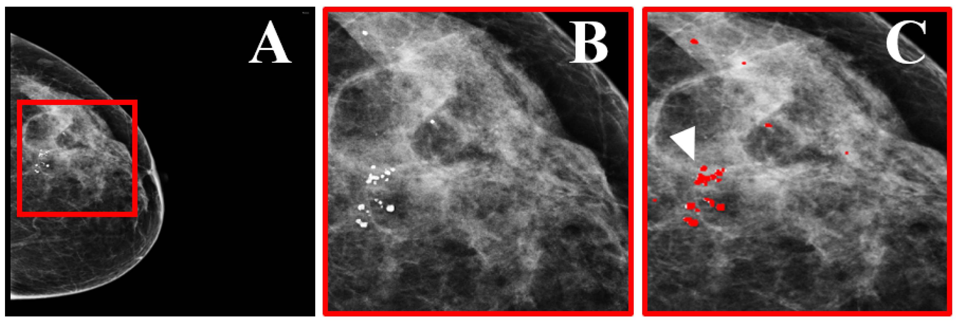 Tomography 08 00241 g008 Tomography 08 00241 g008