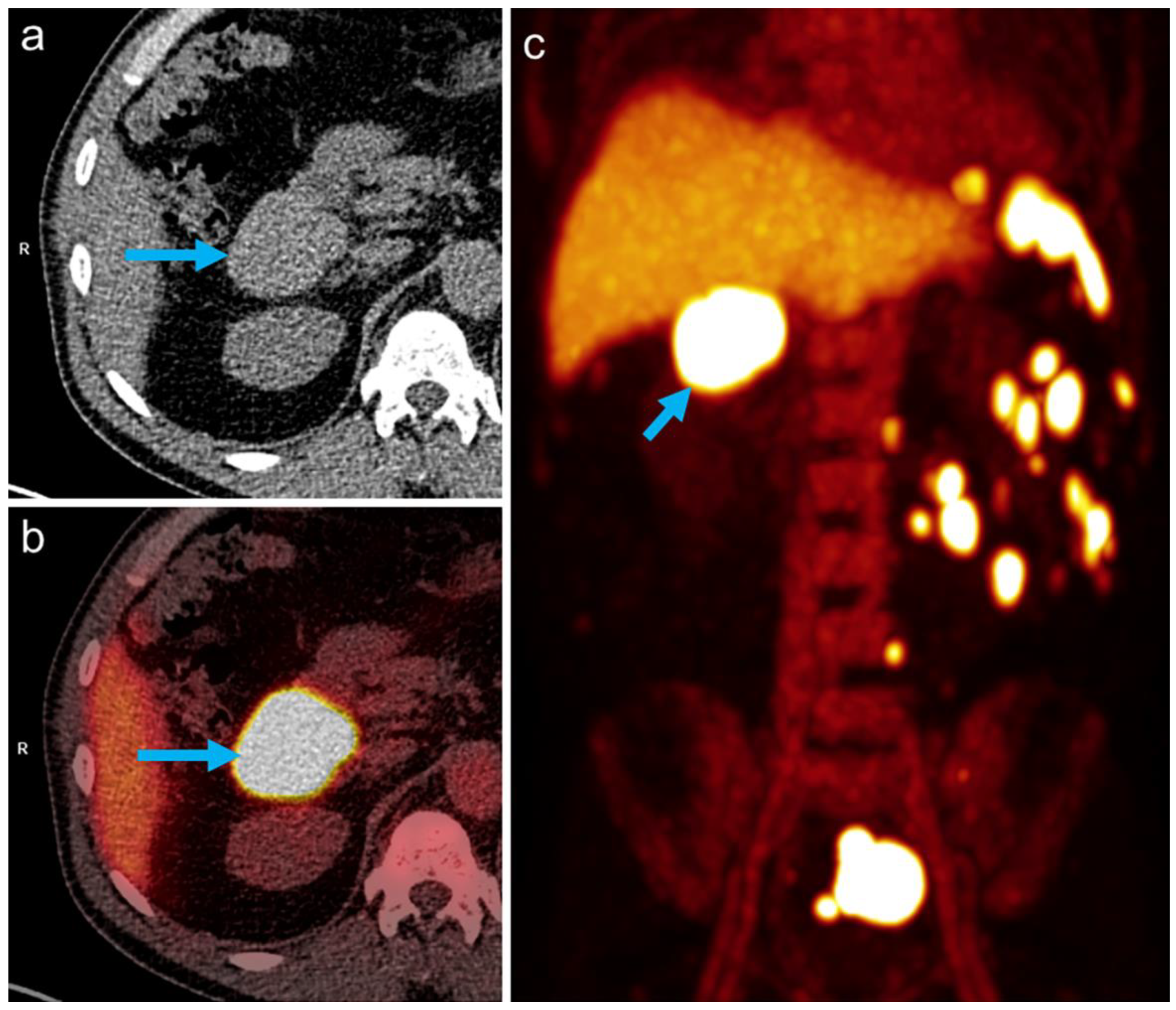 Tomography 08 00244 g002 550