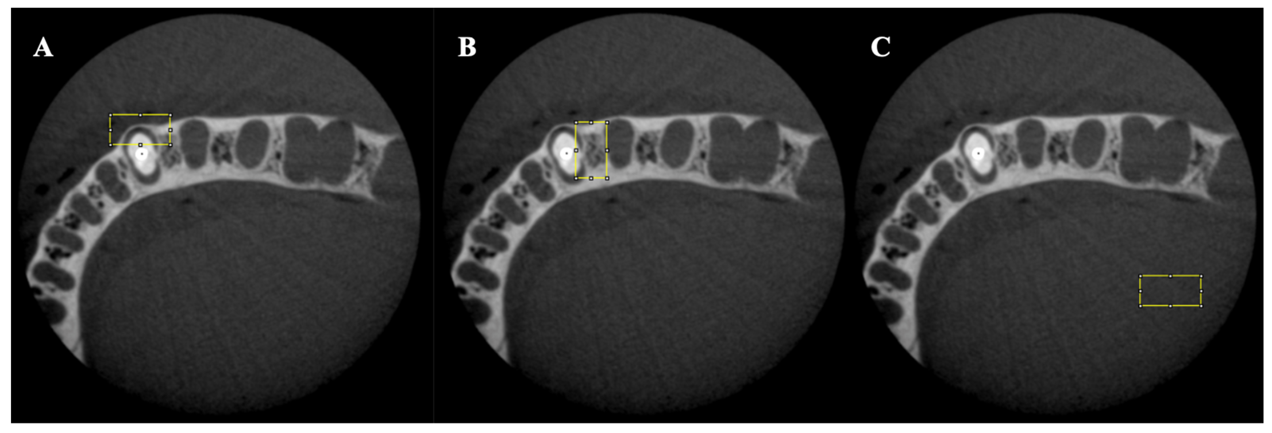 Tomography 08 00245 g003 Tomography 08 00245 g003