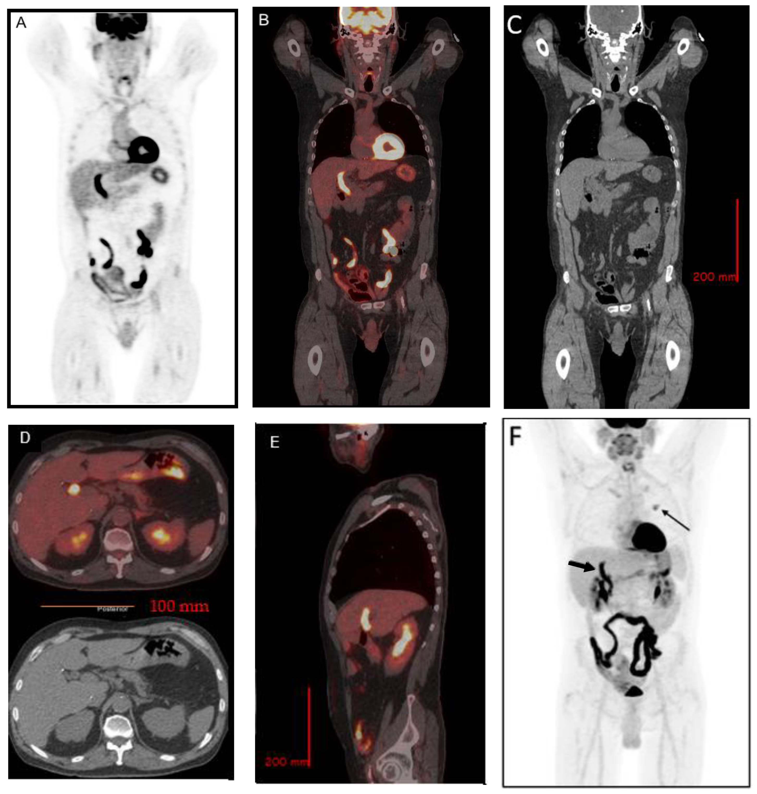 Tomography 08 00248 g002 Tomography 08 00248 g002