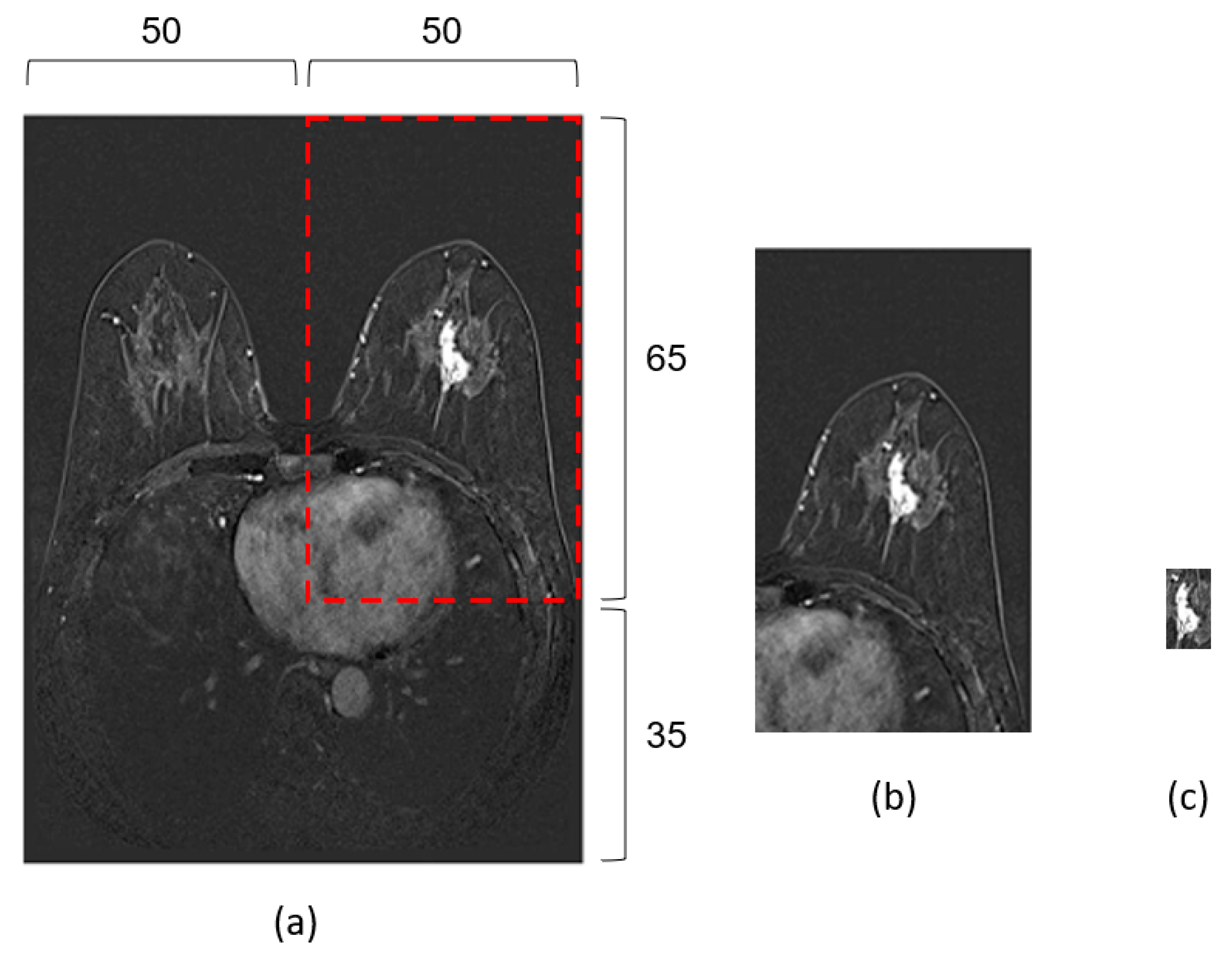 Tomography 09 00001 g002
