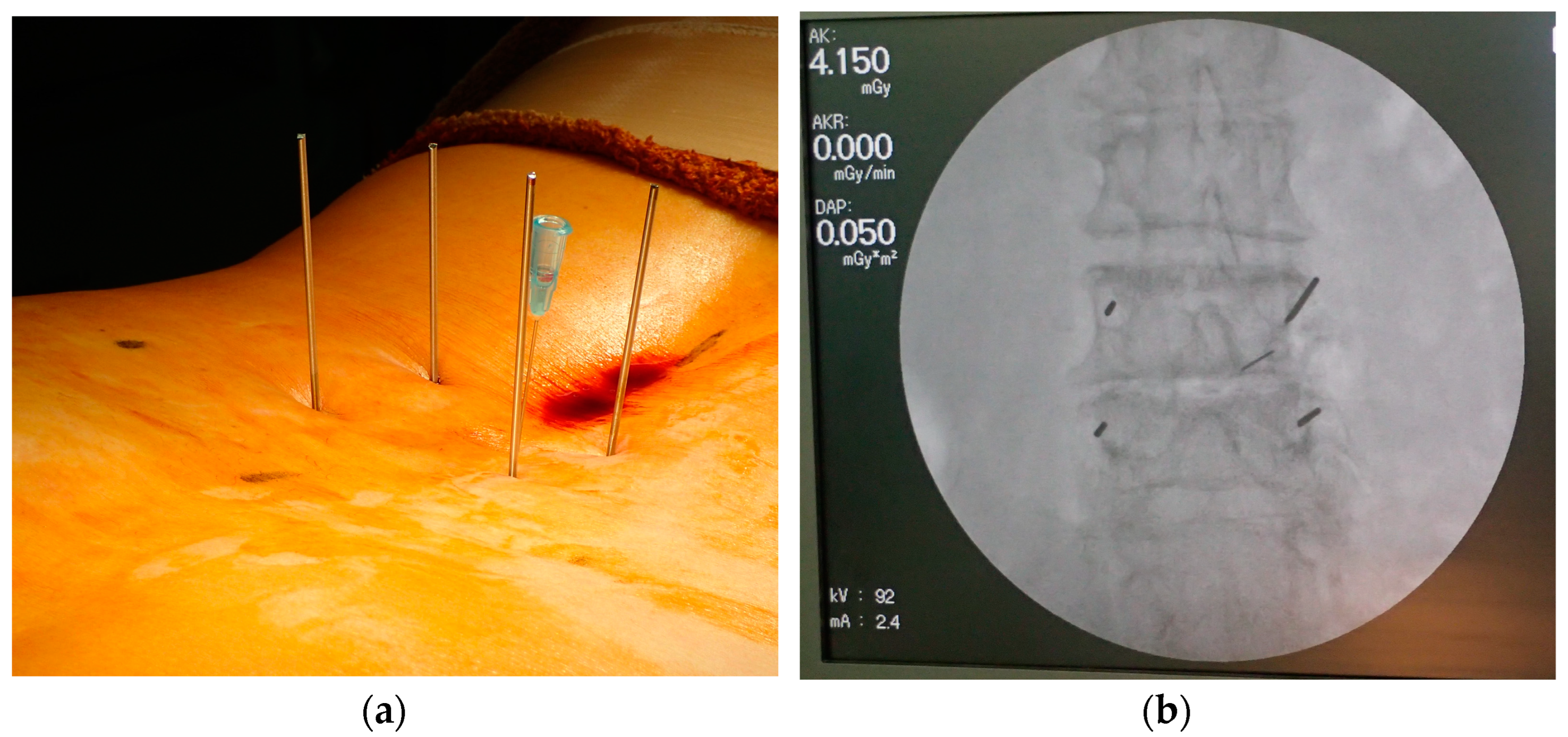 Tomography 09 00002 g002 Tomography 09 00002 g002