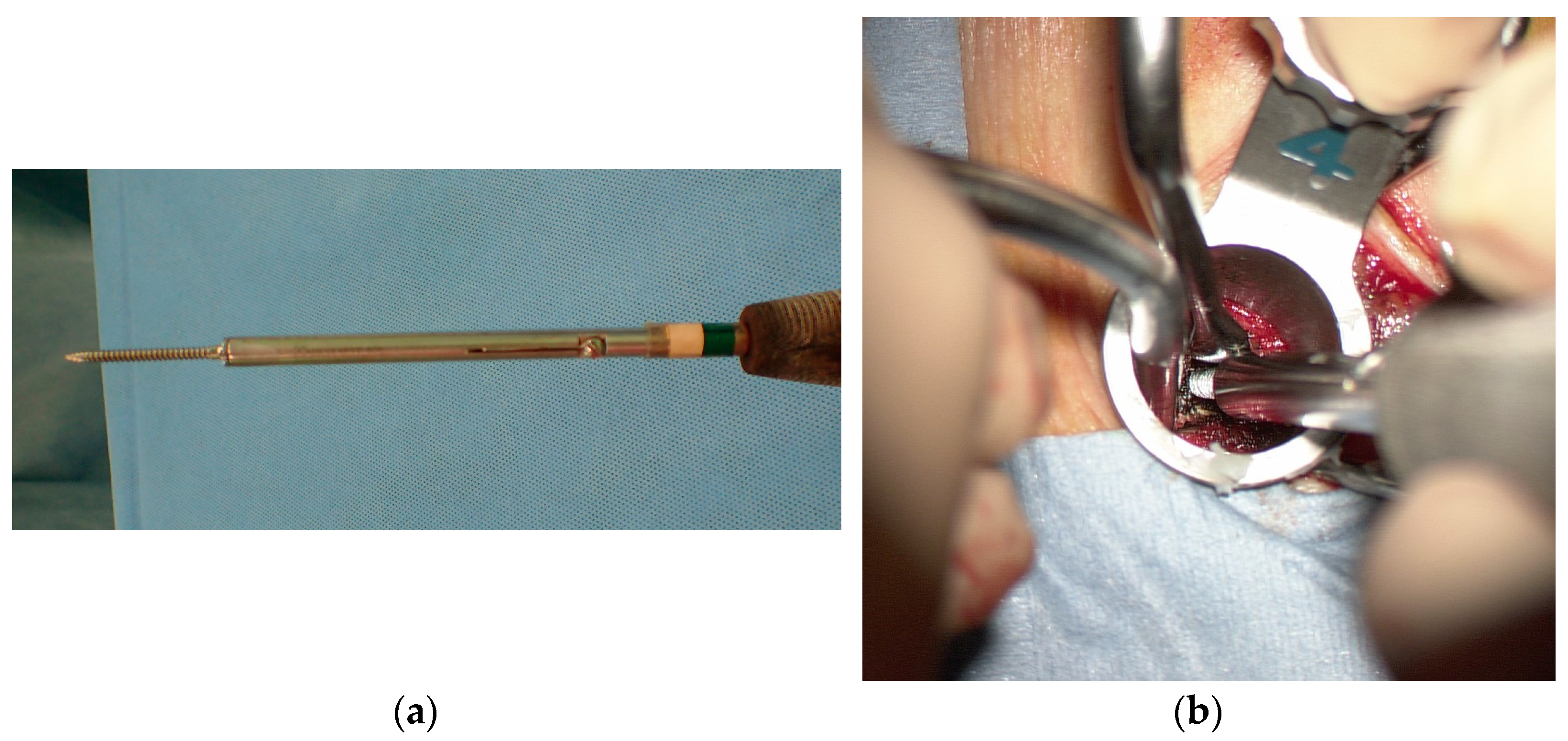 Tomography 09 00002 g004 Tomography 09 00002 g004