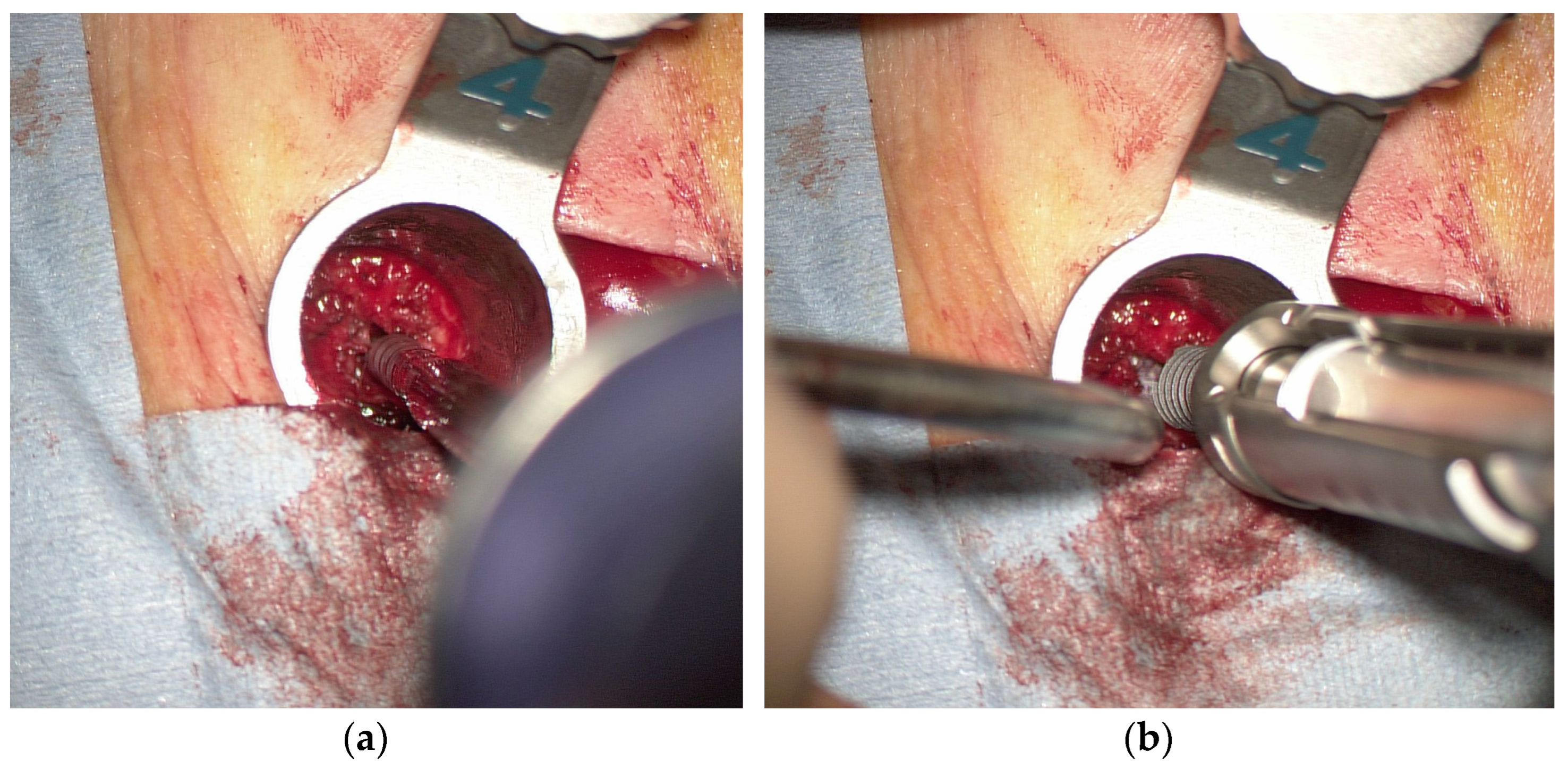 Tomography 09 00002 g006 Tomography 09 00002 g006