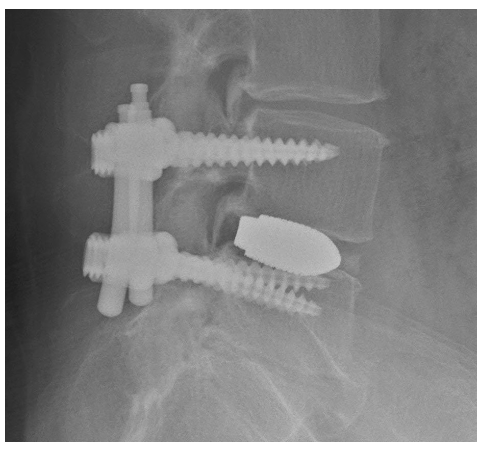 Tomography 09 00002 g008 Tomography 09 00002 g008