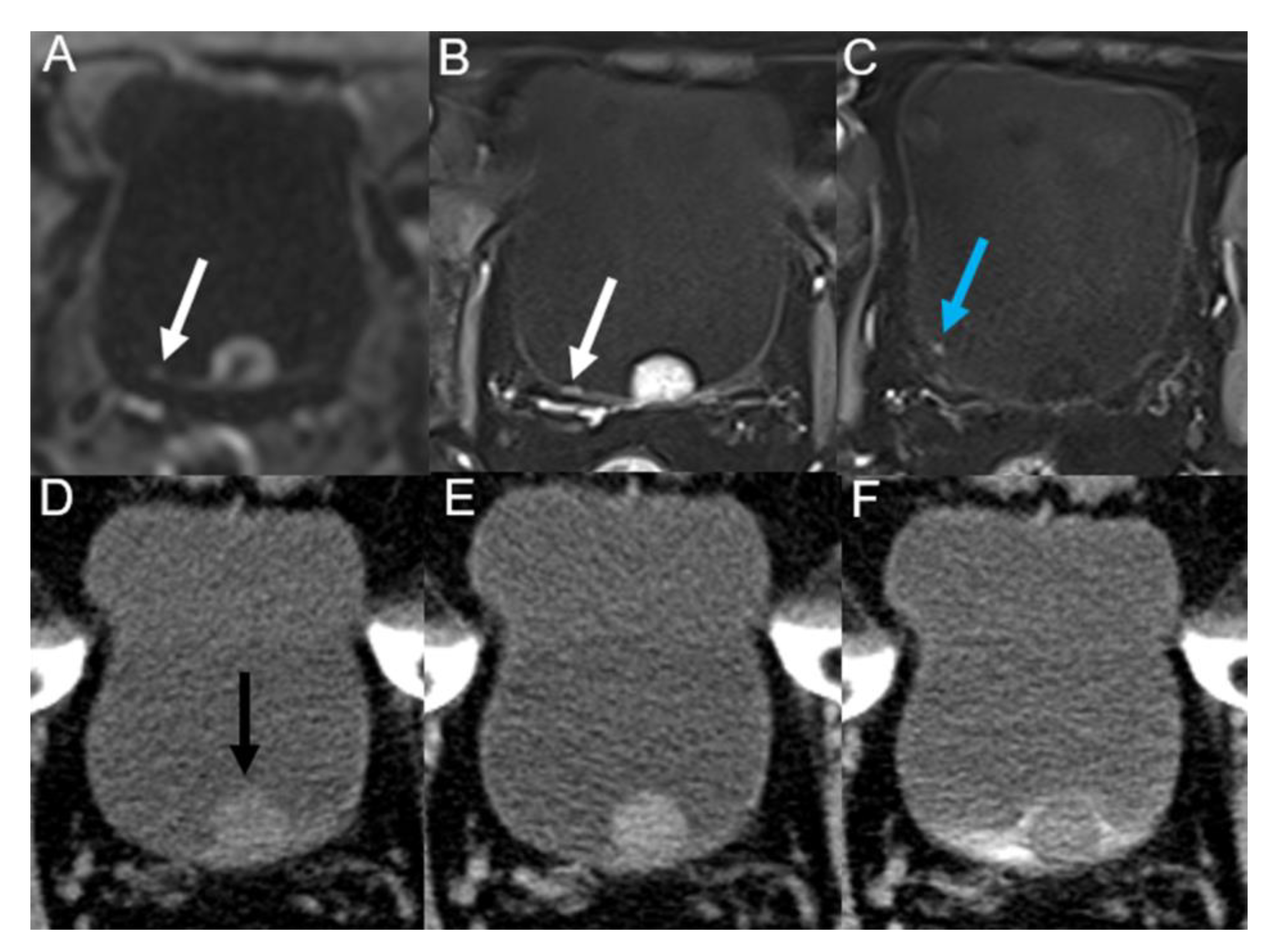 Tomography 09 00003 g003 Tomography 09 00003 g003