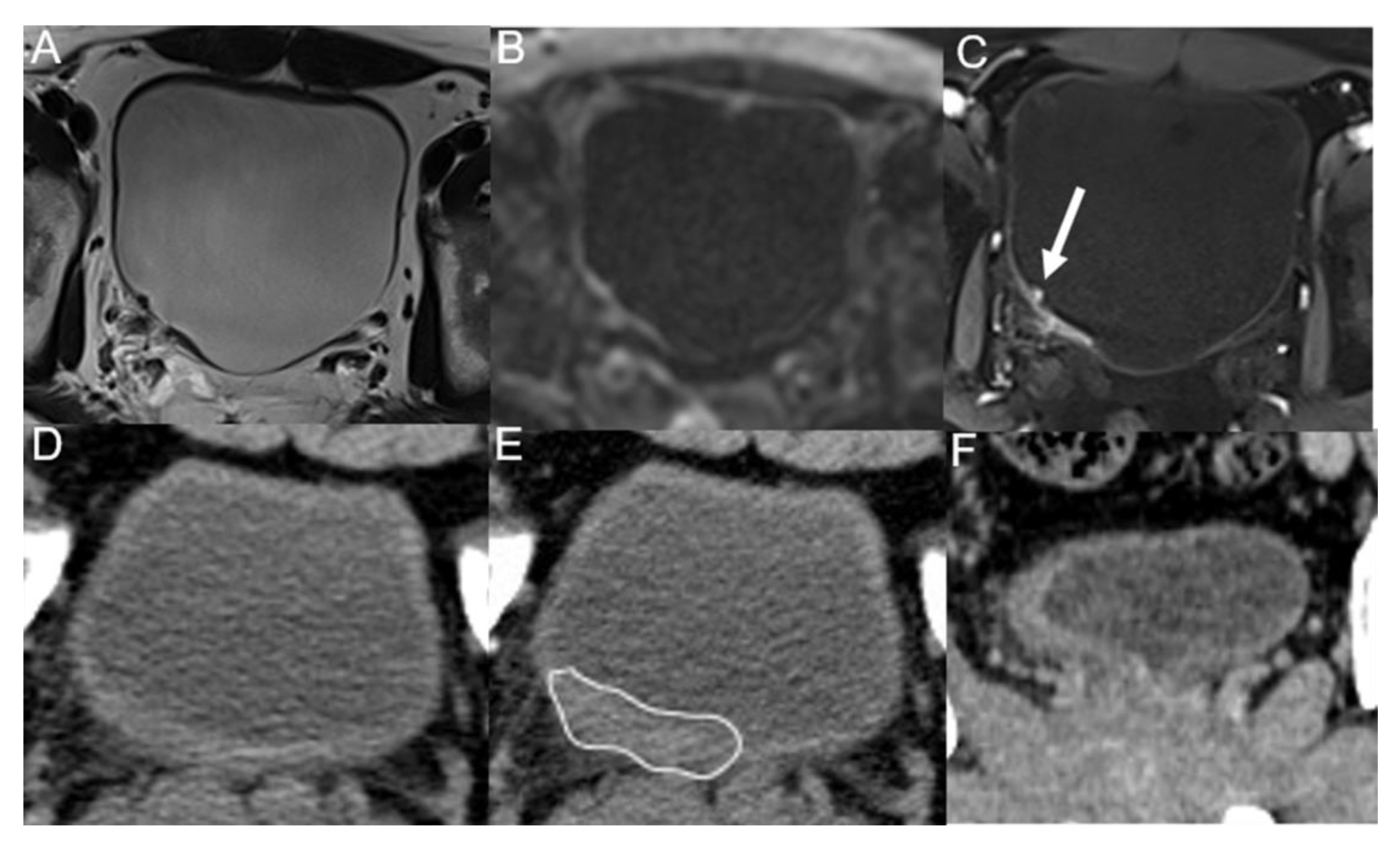 Tomography 09 00003 g005 Tomography 09 00003 g005