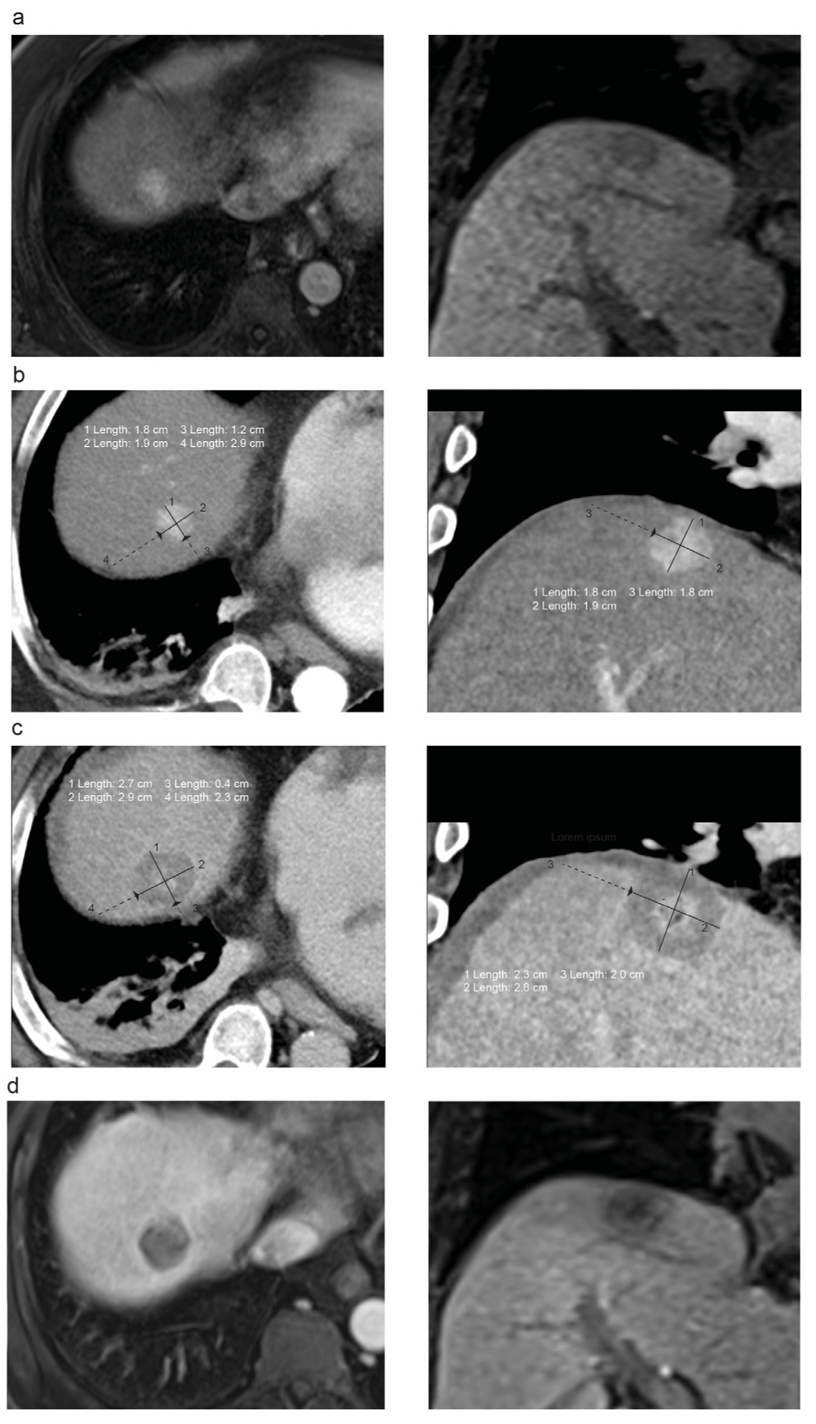 Tomography 09 00005 g002 Tomography 09 00005 g002
