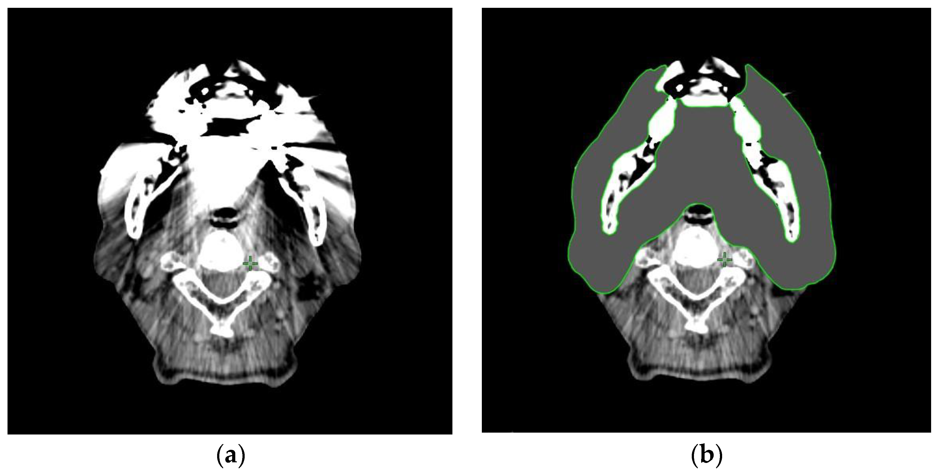 Tomography 09 00009 g001