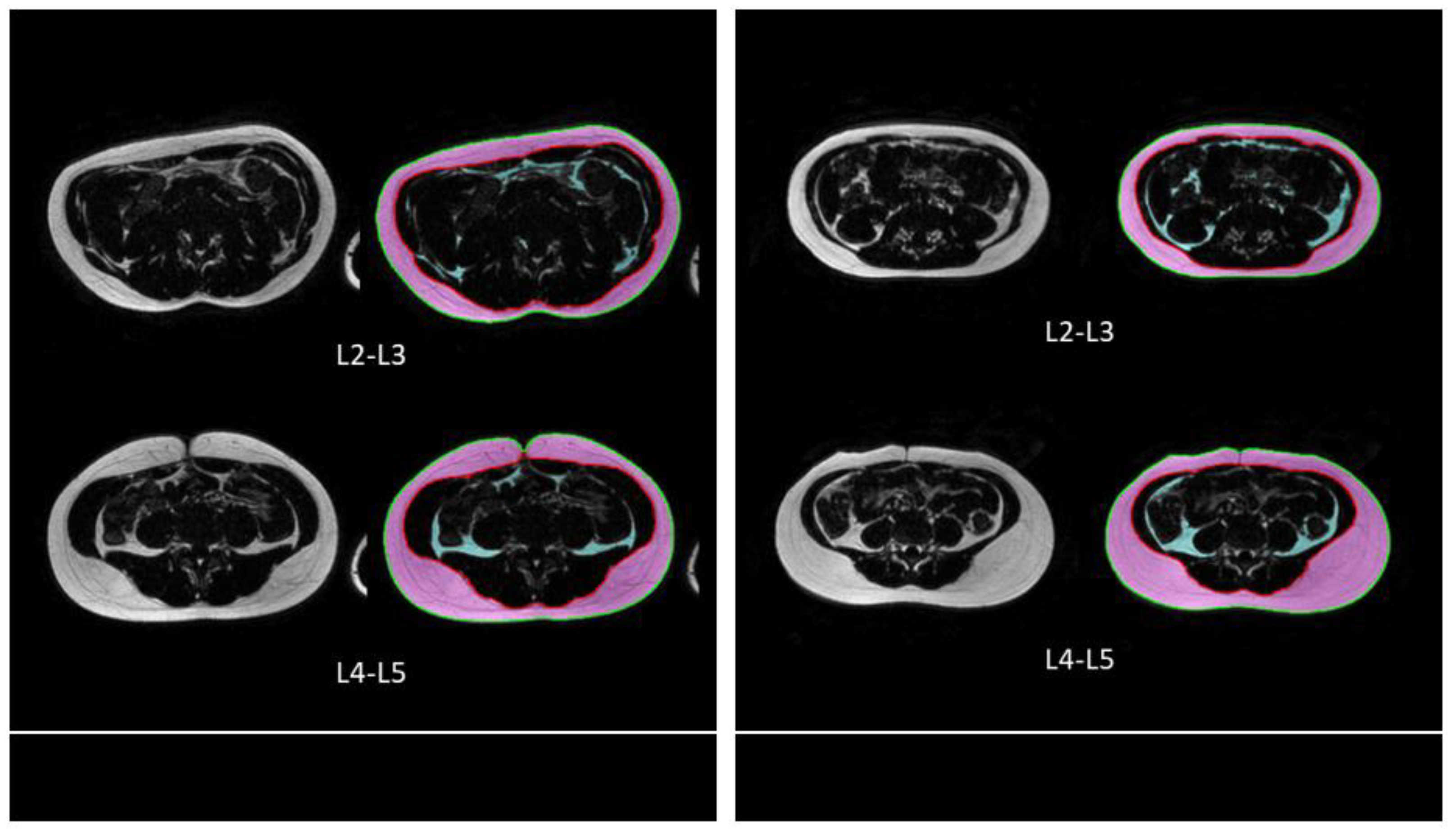 Tomography 09 00012 g002 Tomography 09 00012 g002