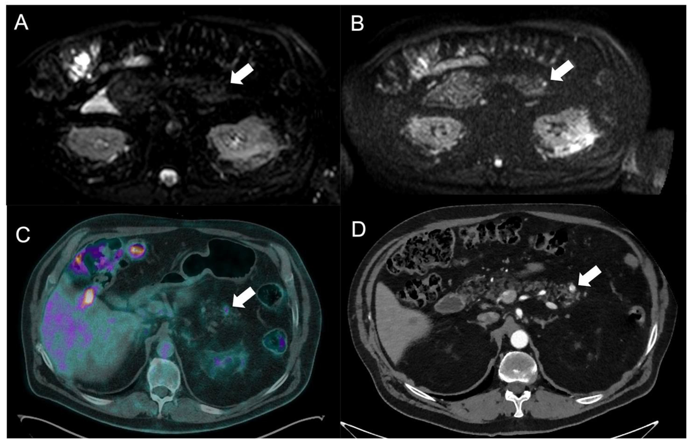 Tomography 09 00018 g002