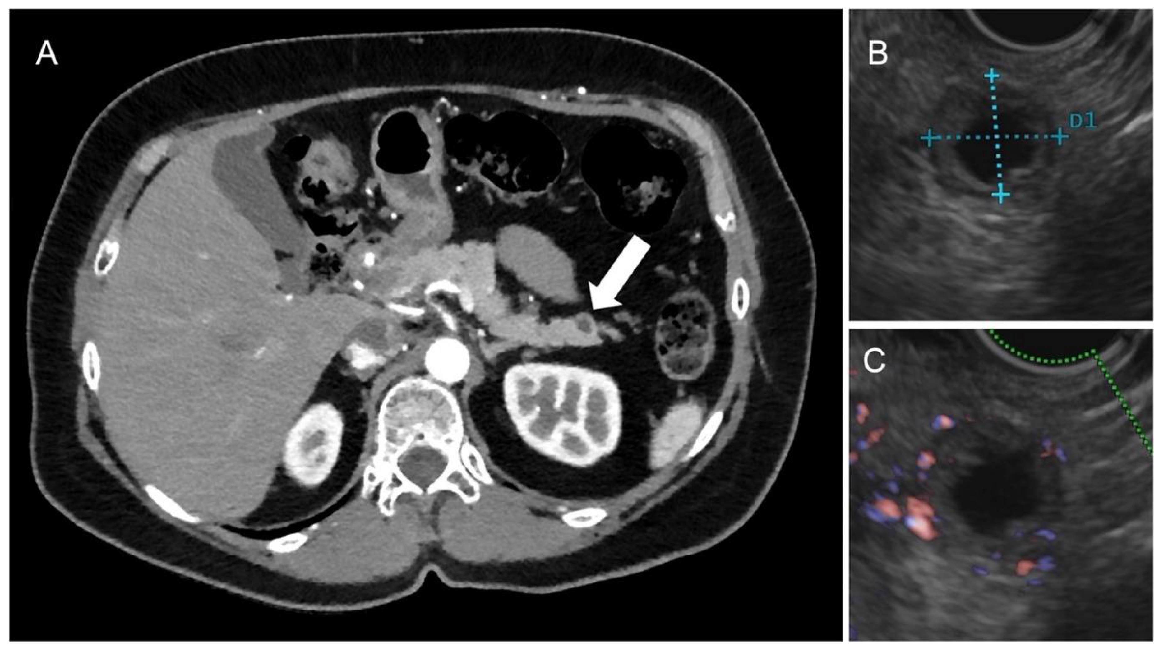 Tomography 09 00018 g003