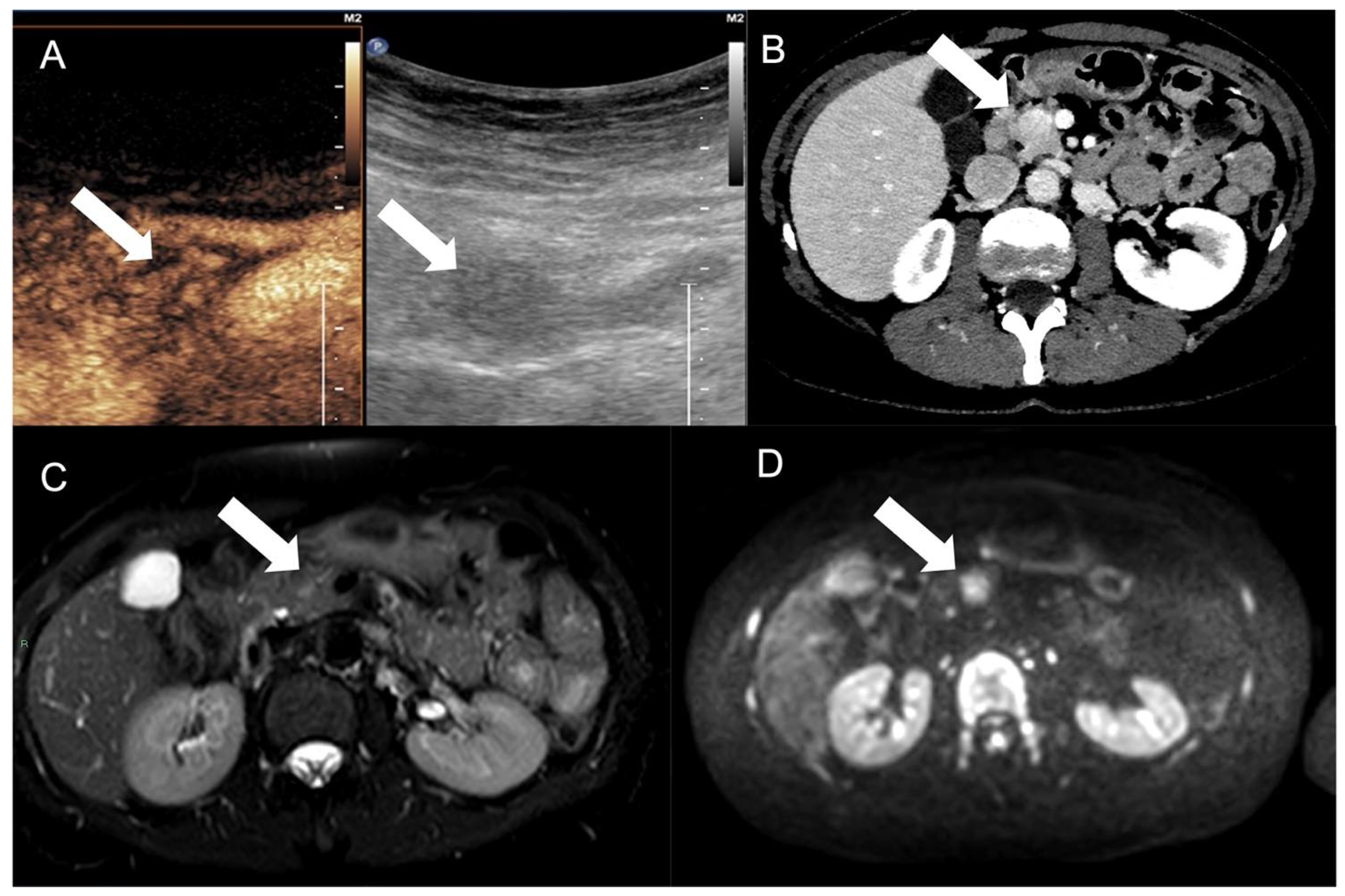 Tomography 09 00018 g004