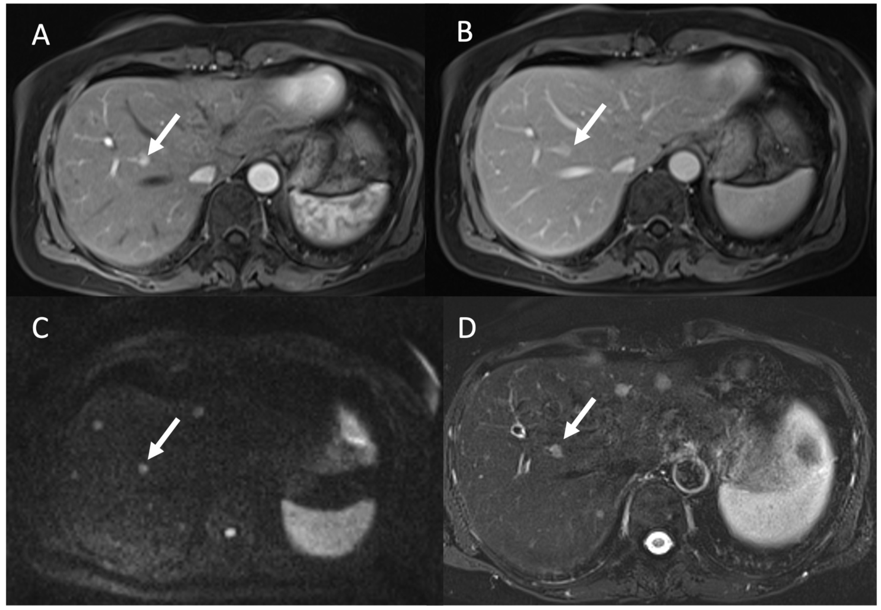 Tomography 09 00018 g005