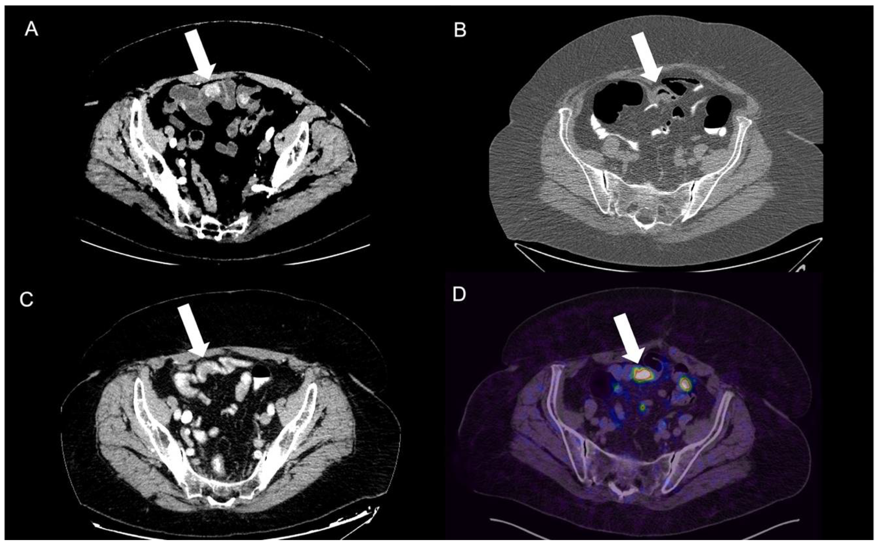 Tomography 09 00018 g006