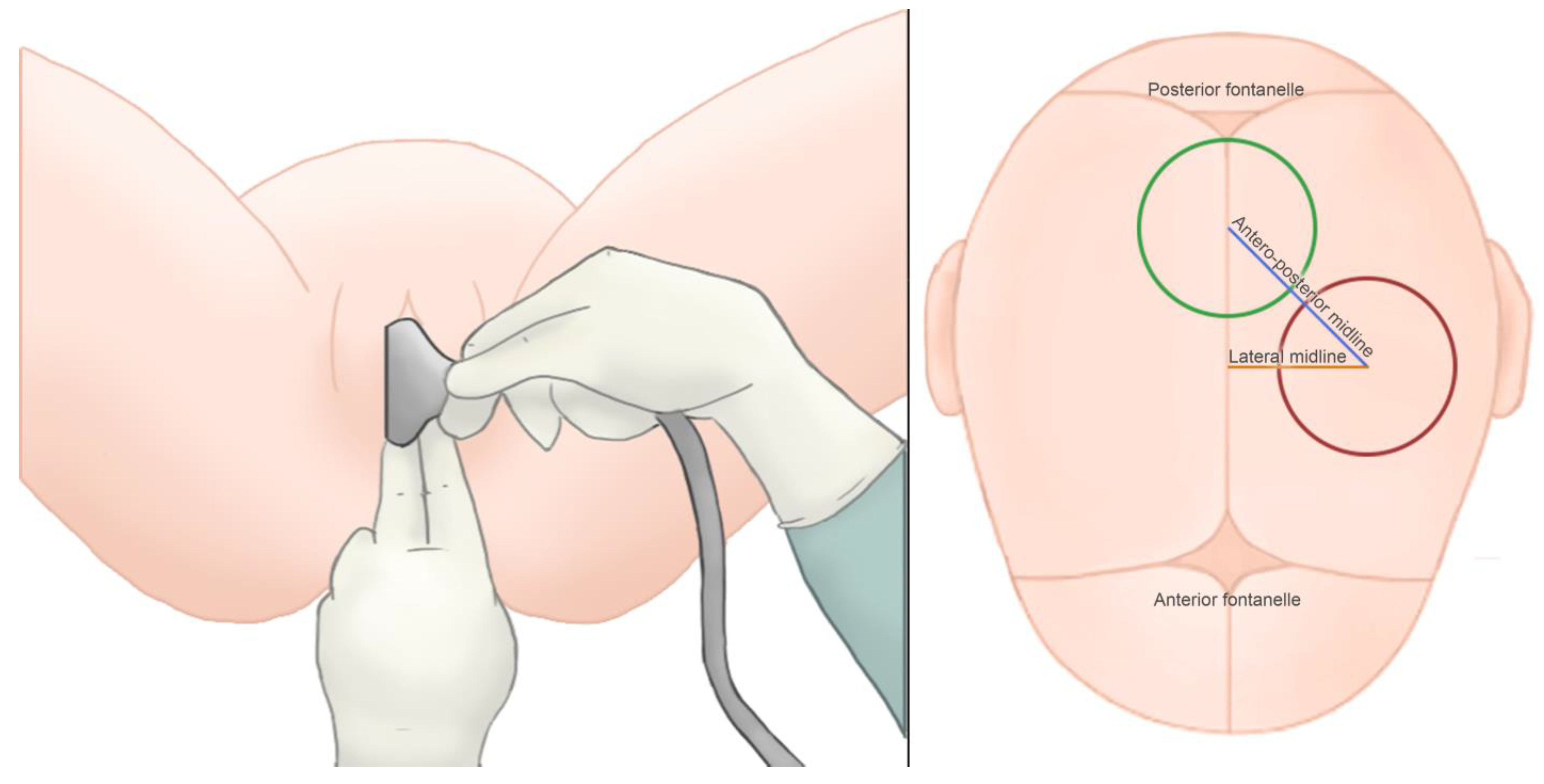 Tomography 09 00019 g003 Tomography 09 00019 g003