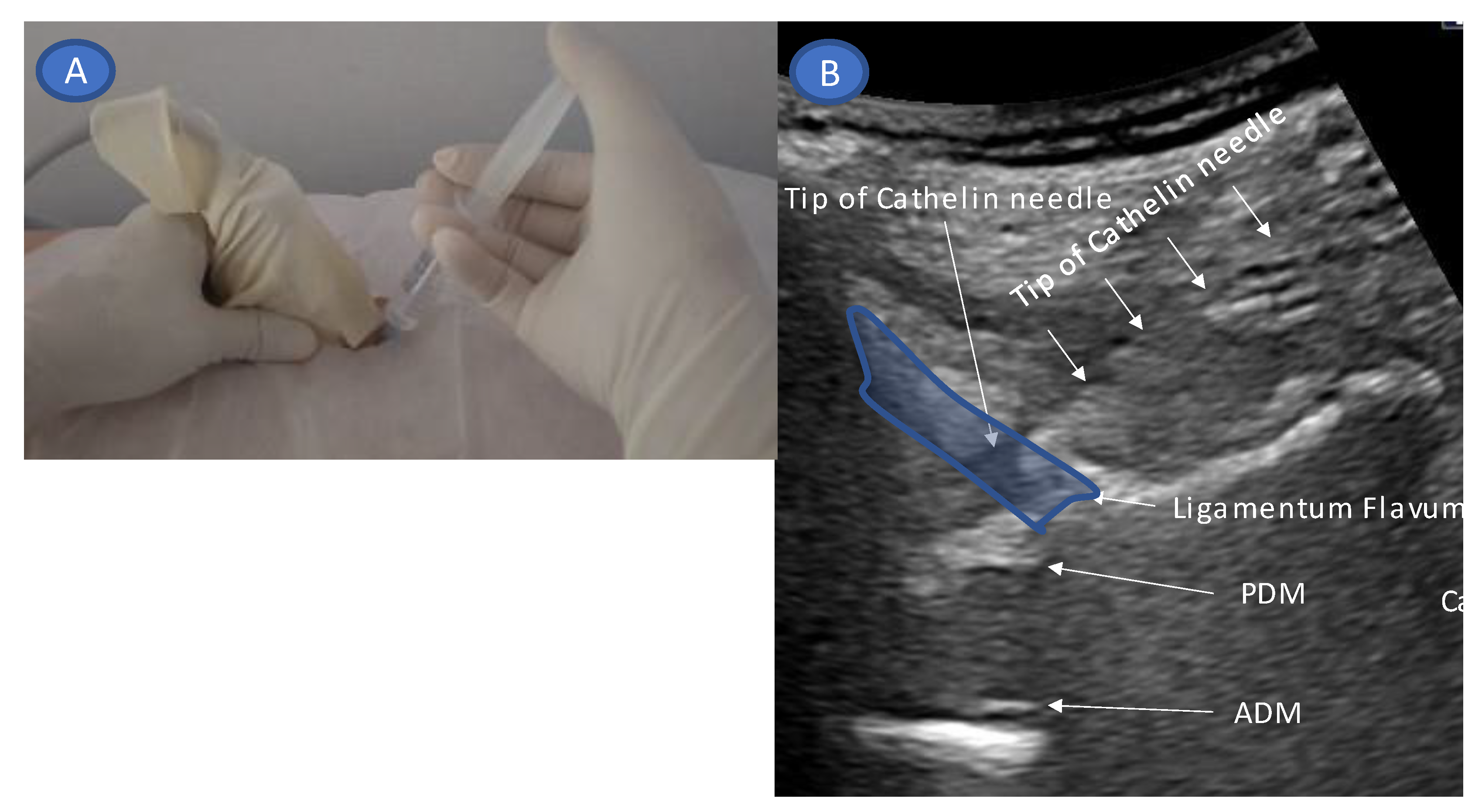 Tomography 09 00023 g004 Tomography 09 00023 g004