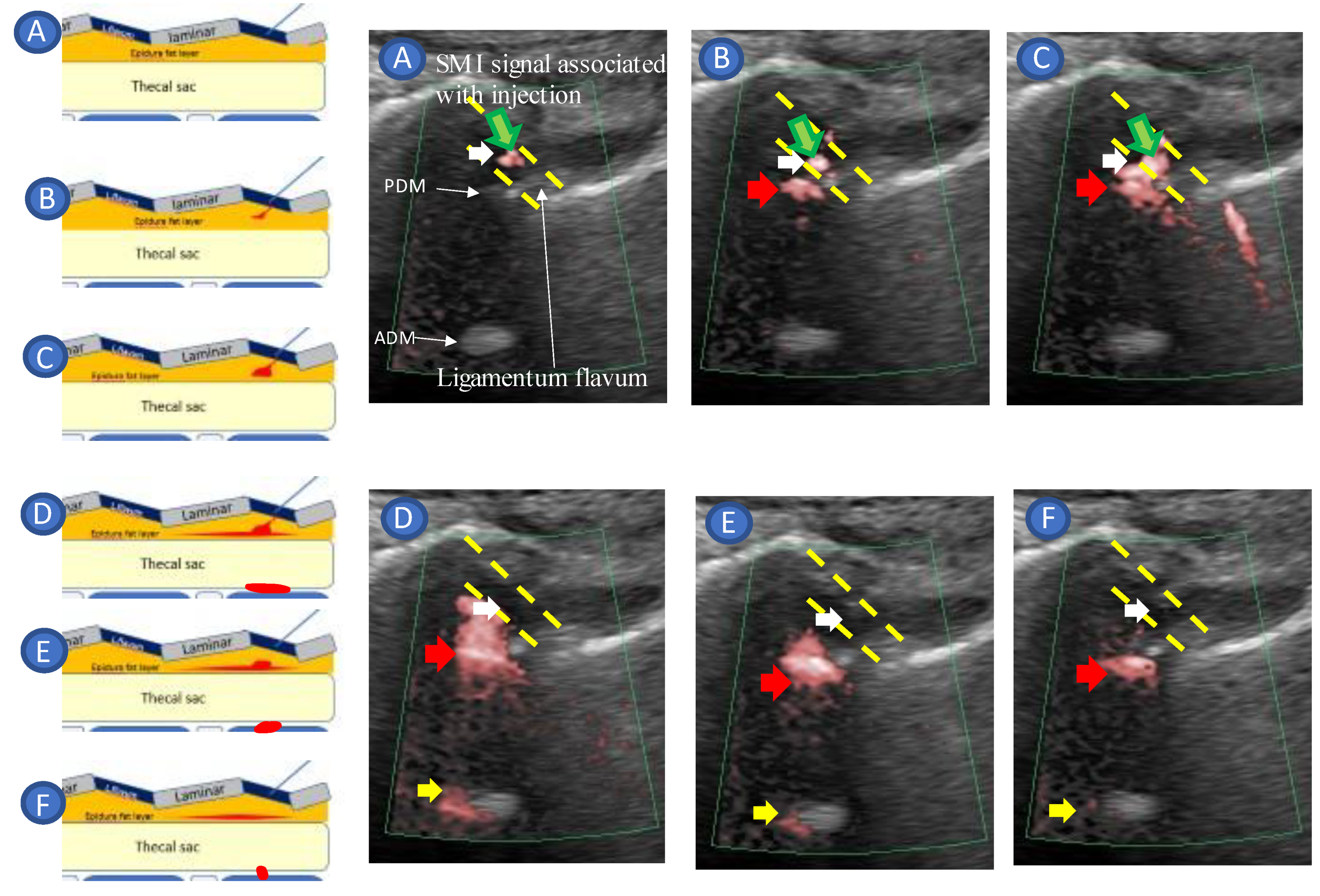 Tomography 09 00023 g005 Tomography 09 00023 g005