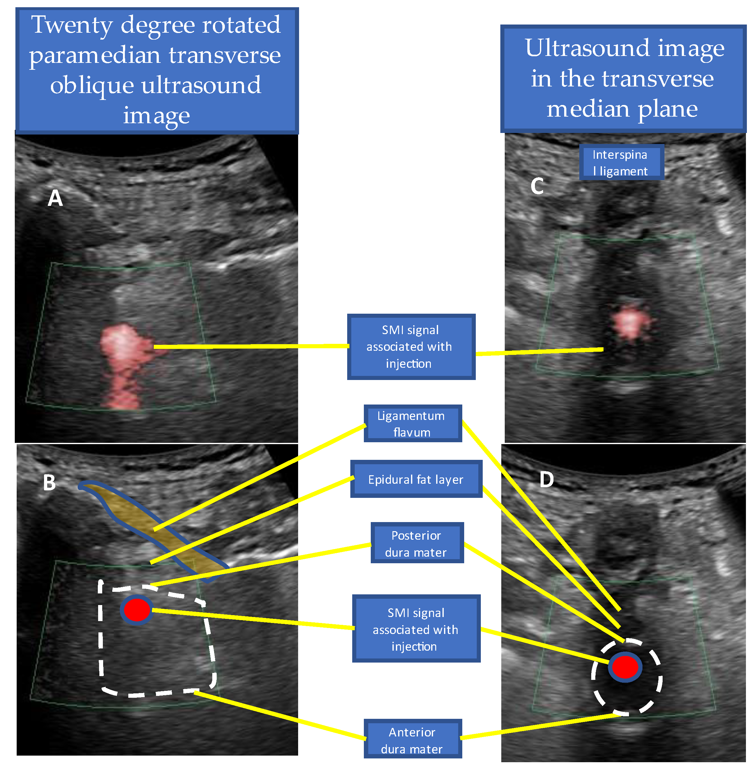Tomography 09 00023 g006 Tomography 09 00023 g006