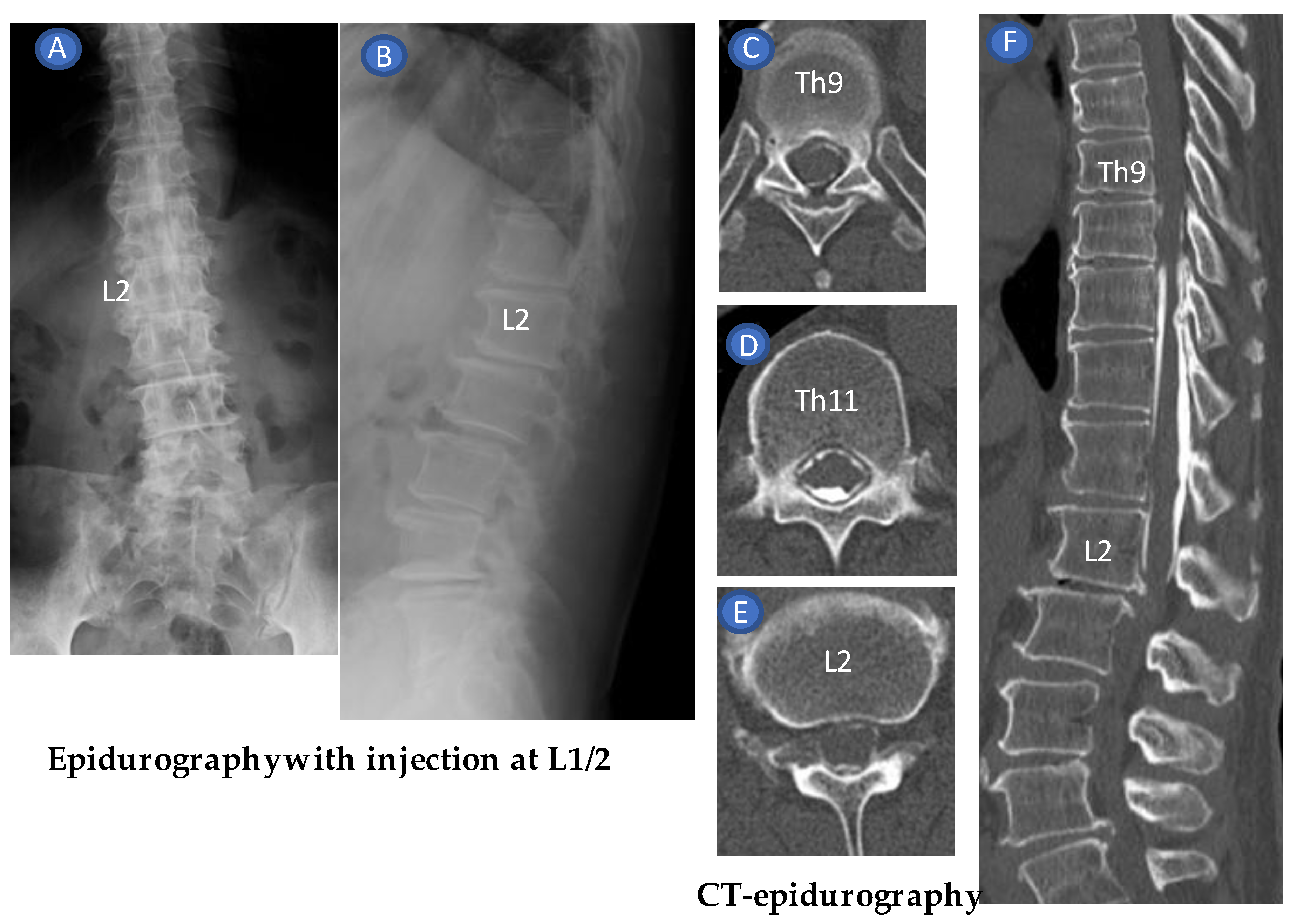 Tomography 09 00023 g010 Tomography 09 00023 g010